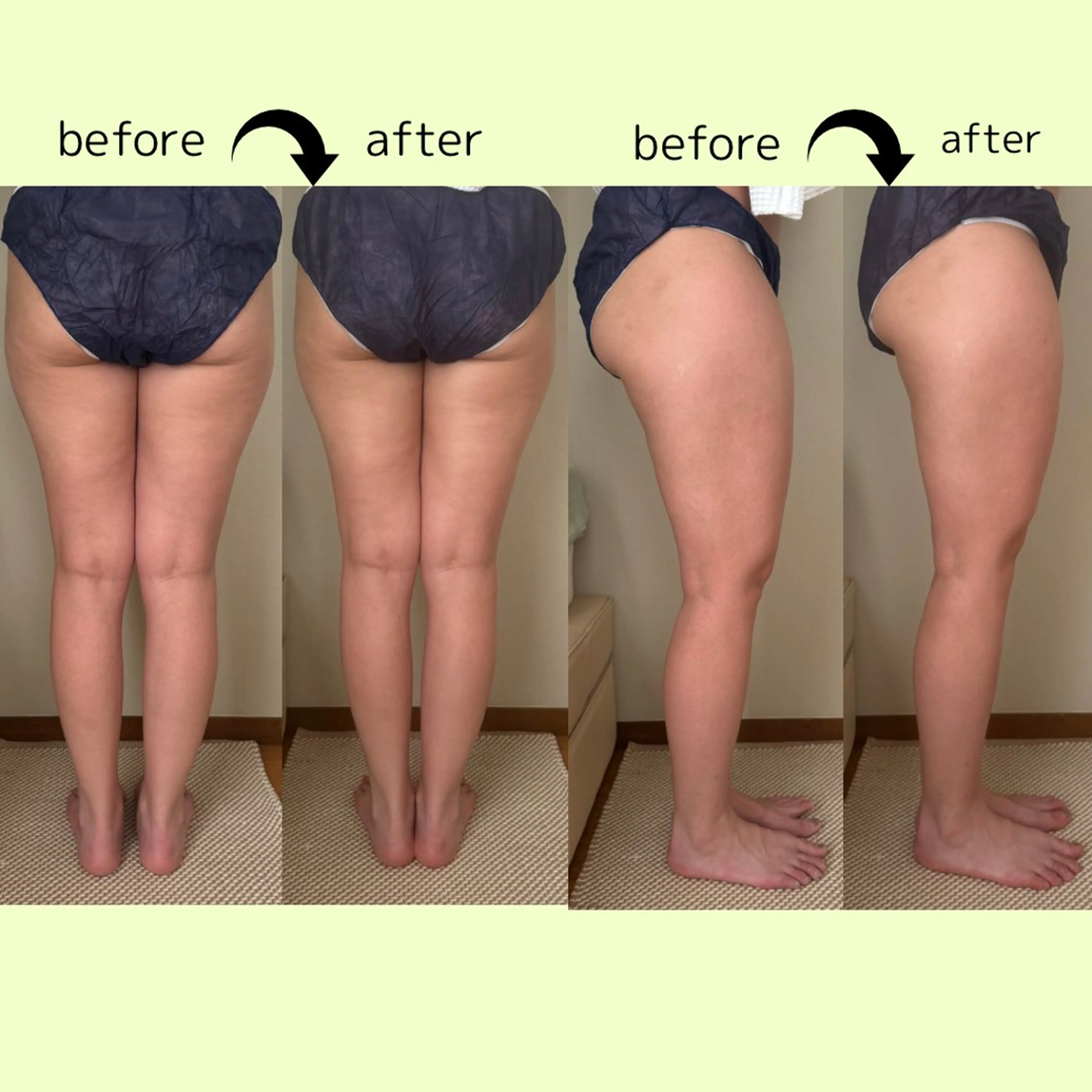 リラクゼーションスパ　ひのき所属・spaHINOKI 【女性専用】のエステ・リラクイメージ