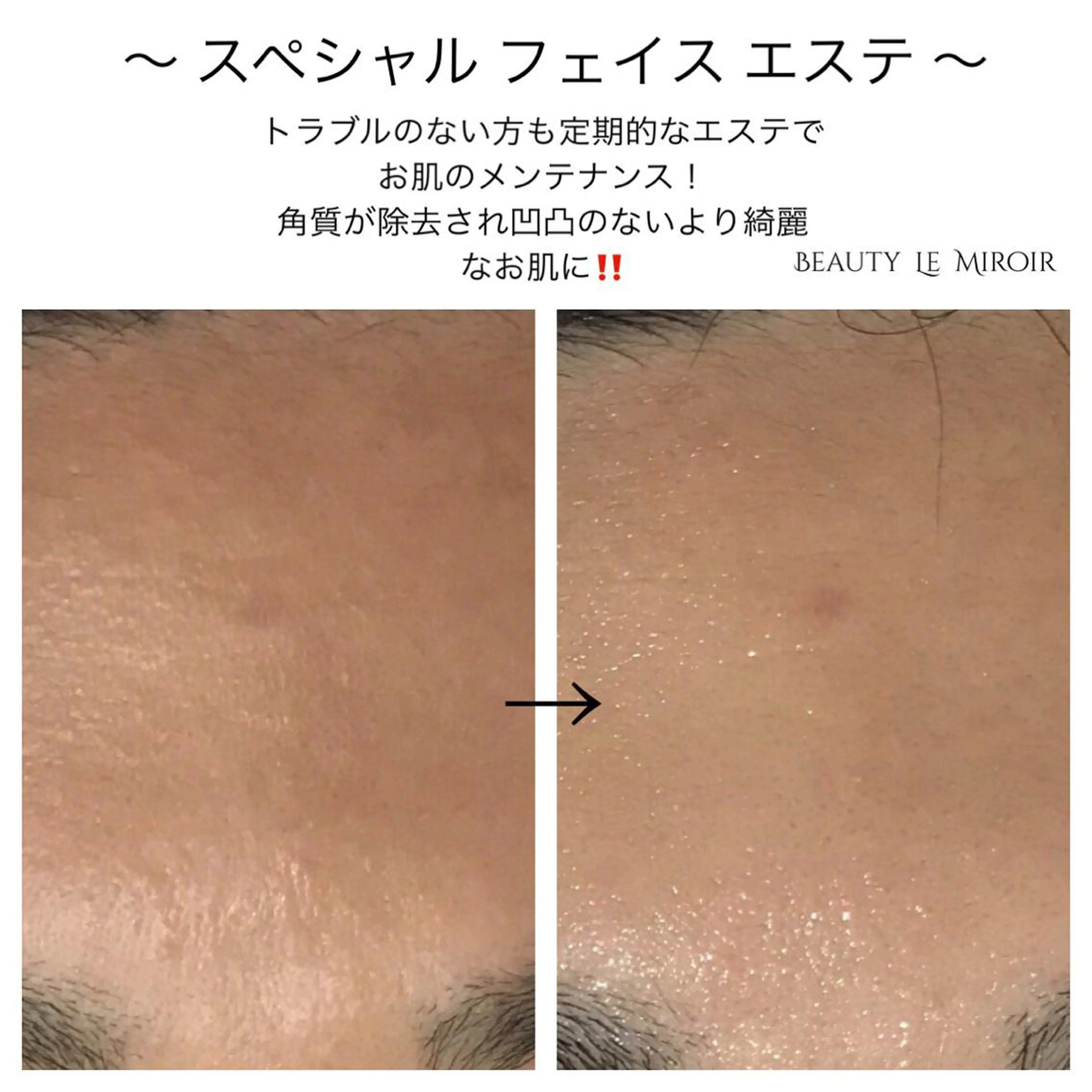 ビューティー ミロワールのエステ・リラクイメージ