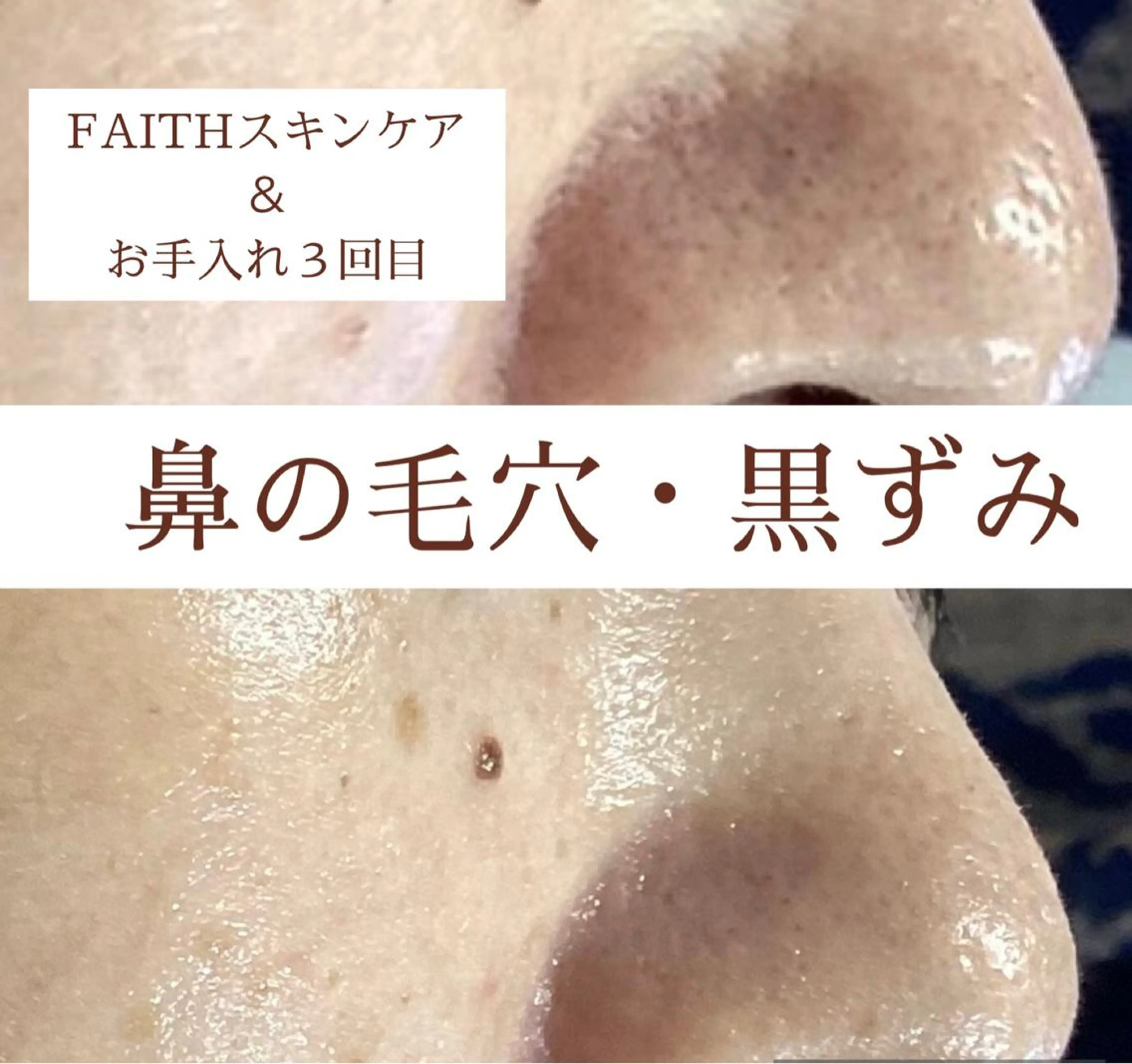 エステ 都度払い 肌質改善専門サロンのエステ・リラクイメージ