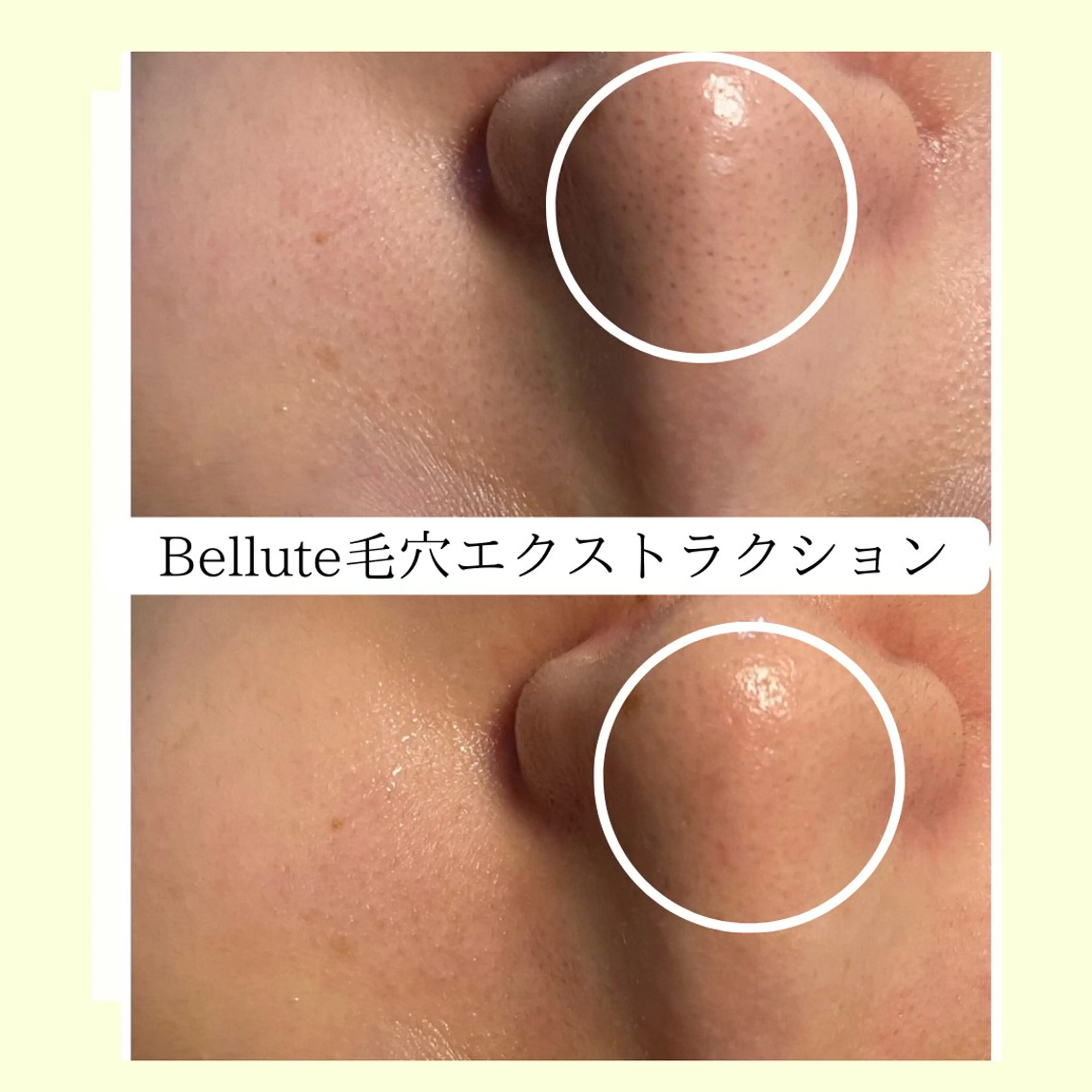 エステ リラク ピーリング専門店 Belluteのエステ・リラクイメージ