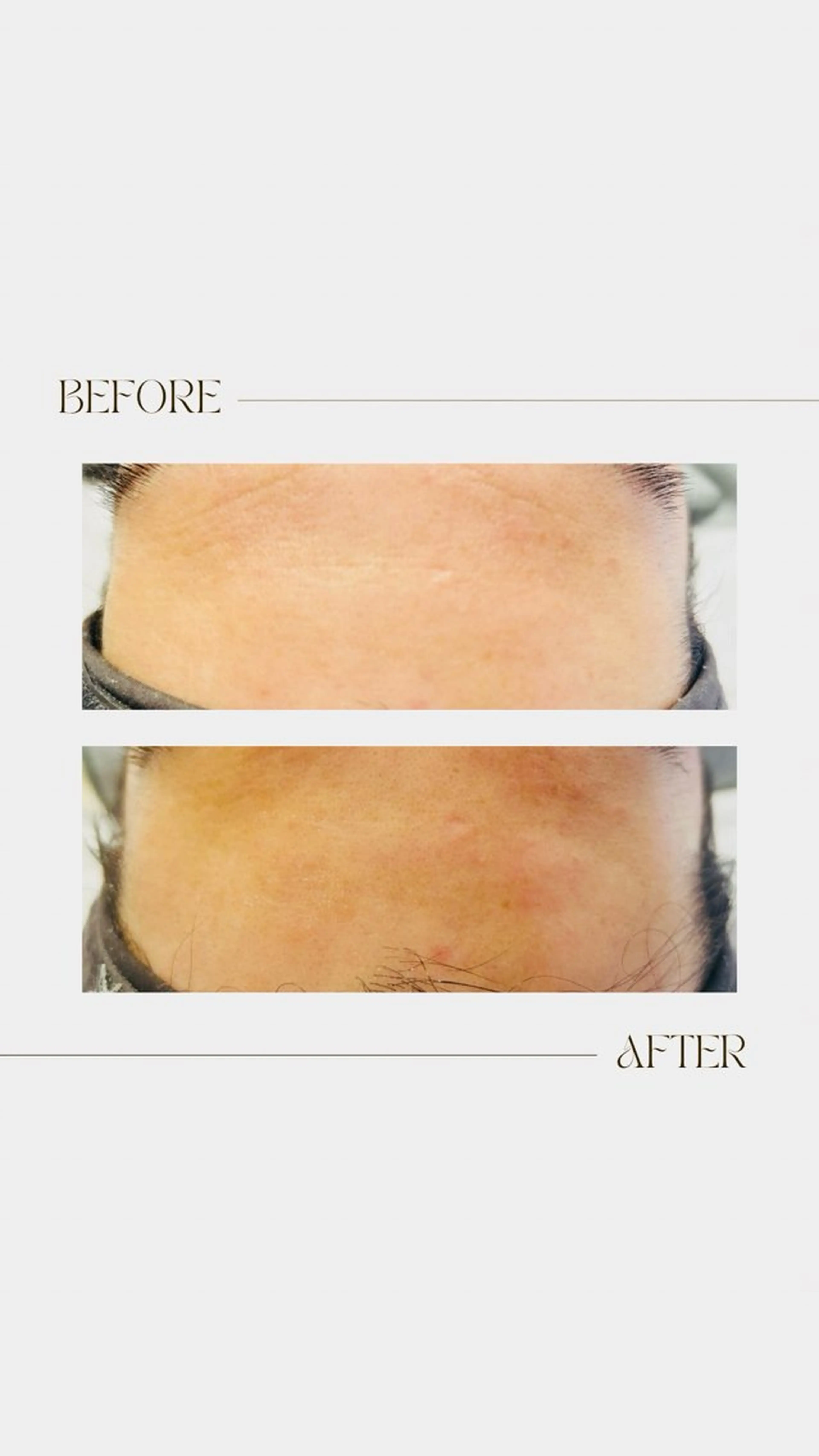 Myuraオーナー MIYUのエステ・リラクイメージ