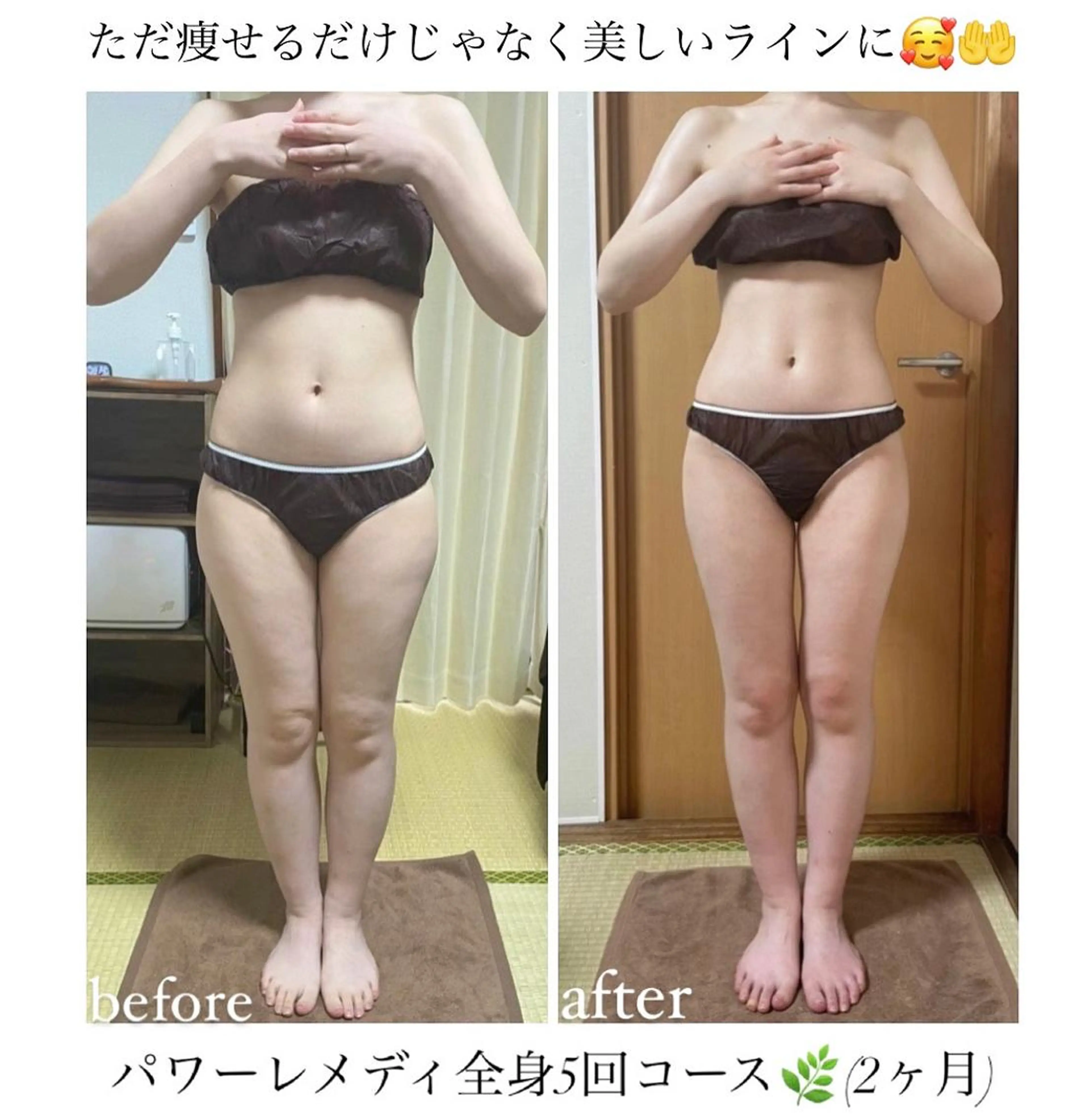 《本気痩せ×疲労改善 》  BILOOPのエステ・リラクイメージ