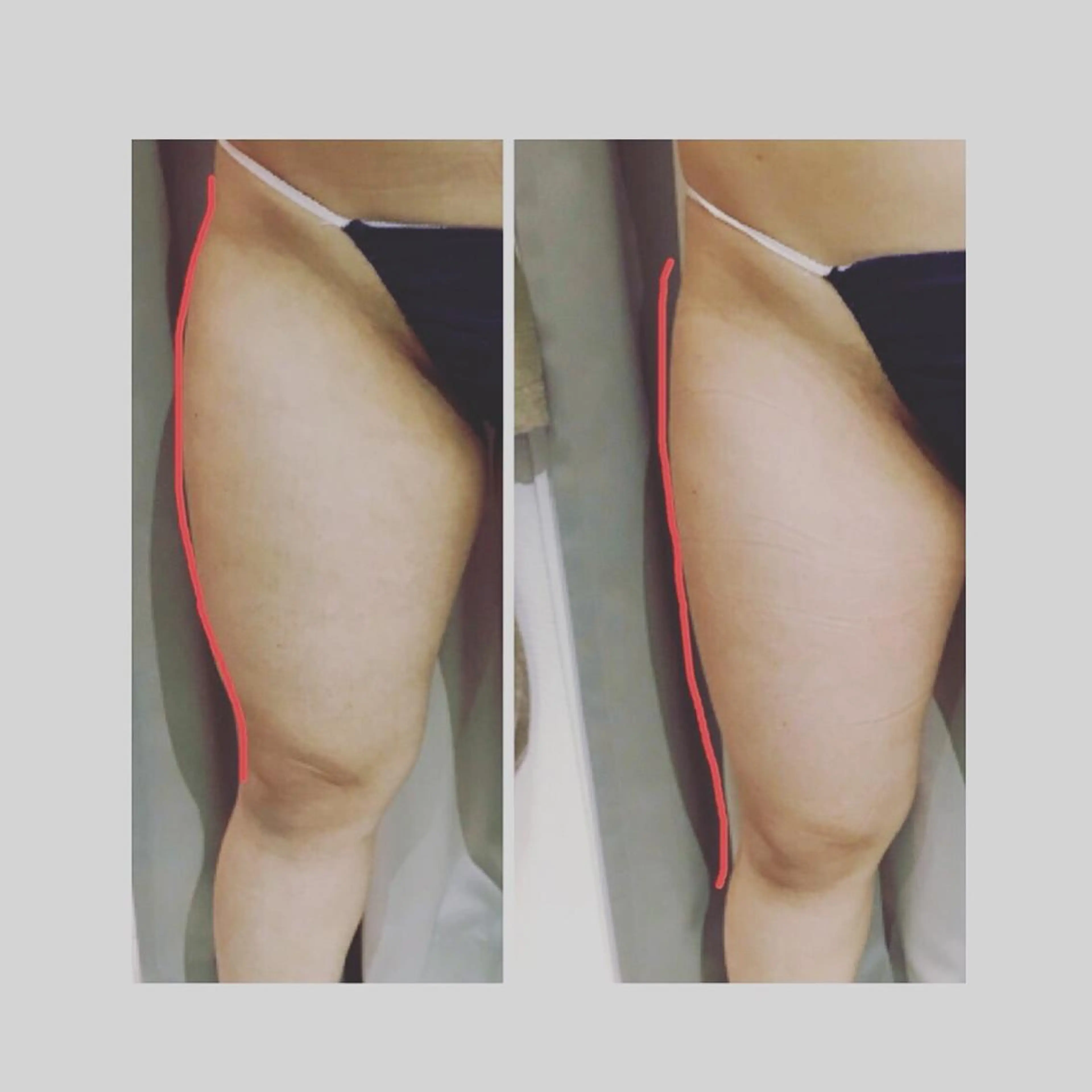 代表 MOMOのエステ・リラクイメージ