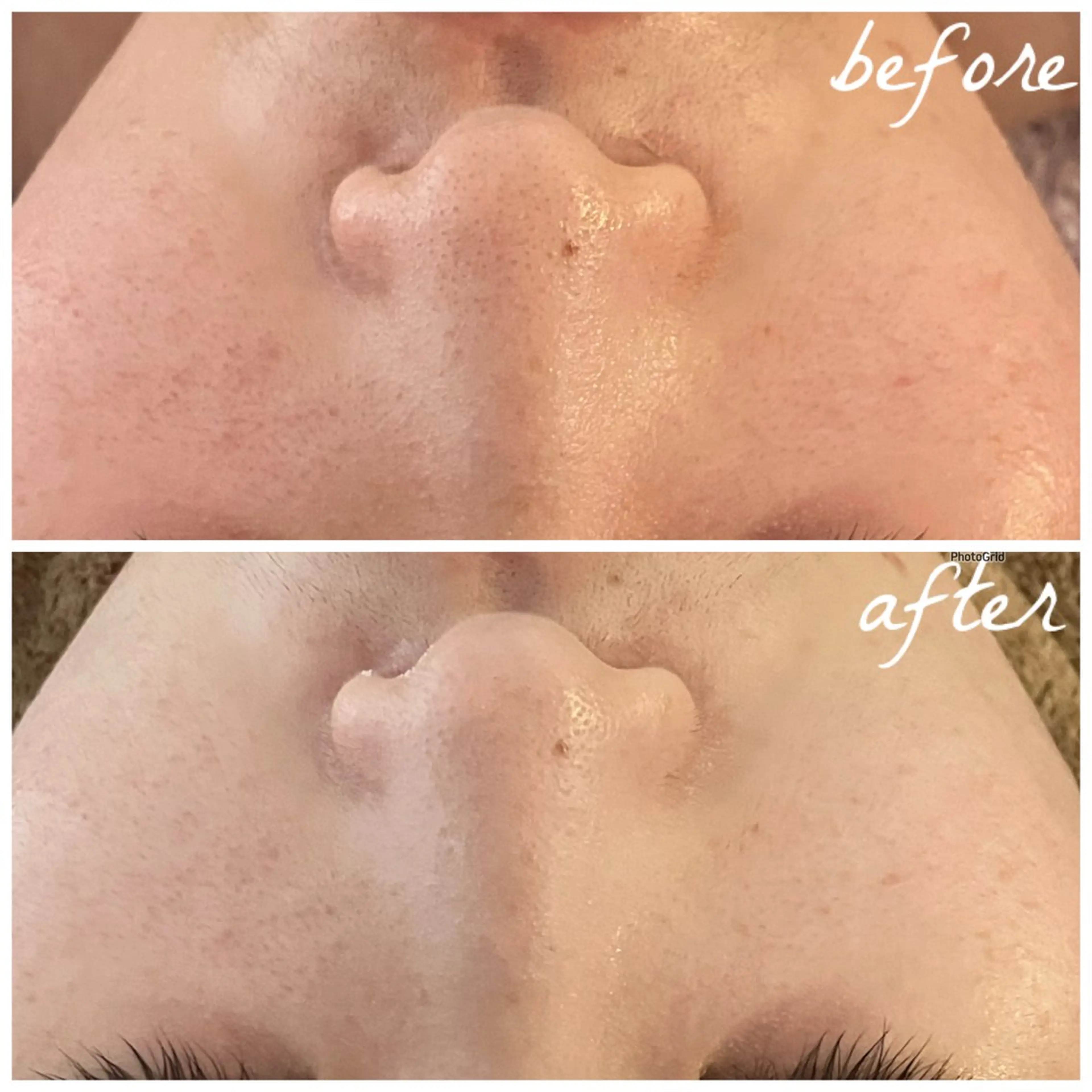 メンズ エステ メナード岐阜茜部 杉浦のエステ・リラクイメージ