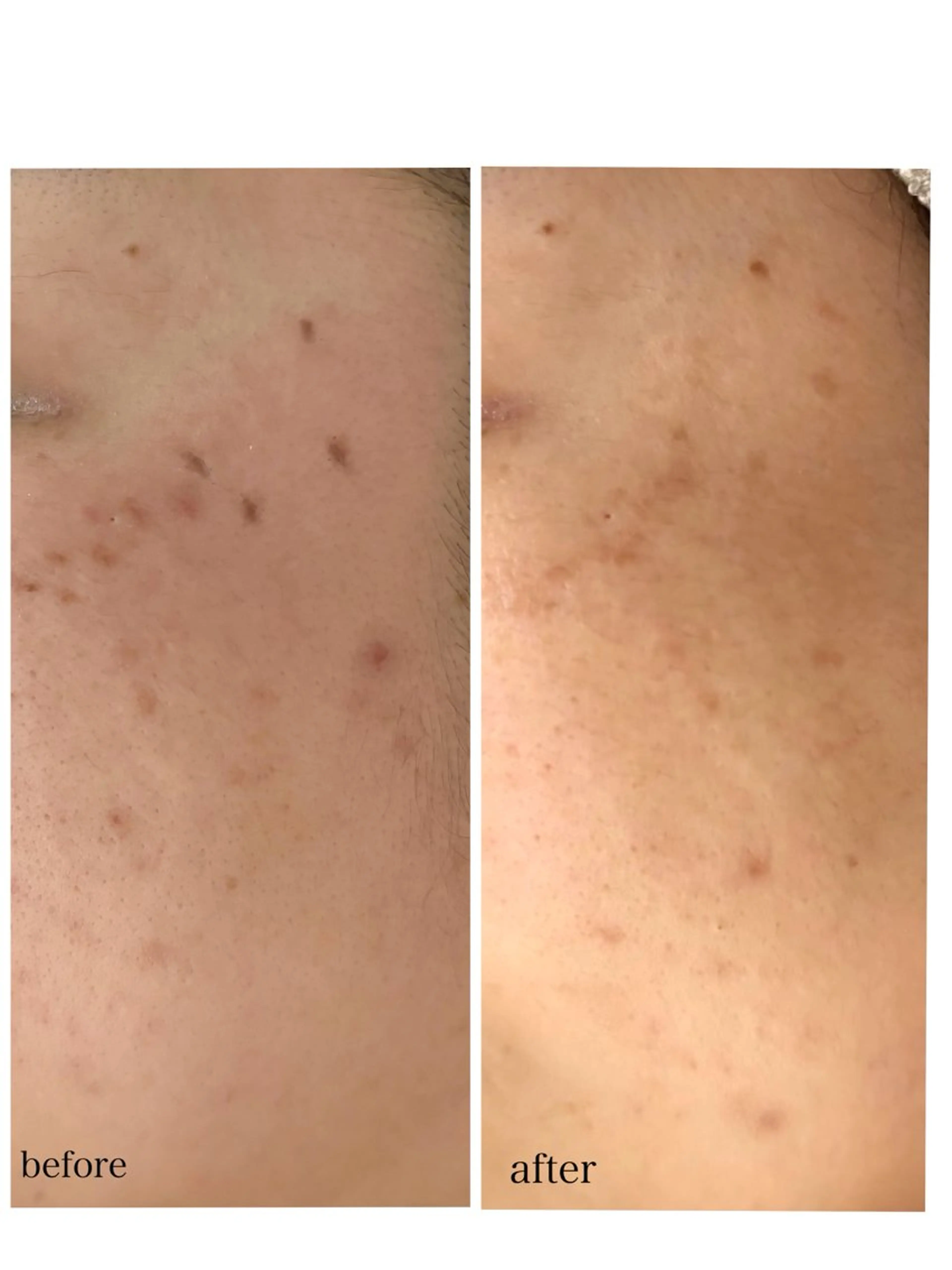 毛穴・シミ専門サロン ルパークのエステ・リラクイメージ