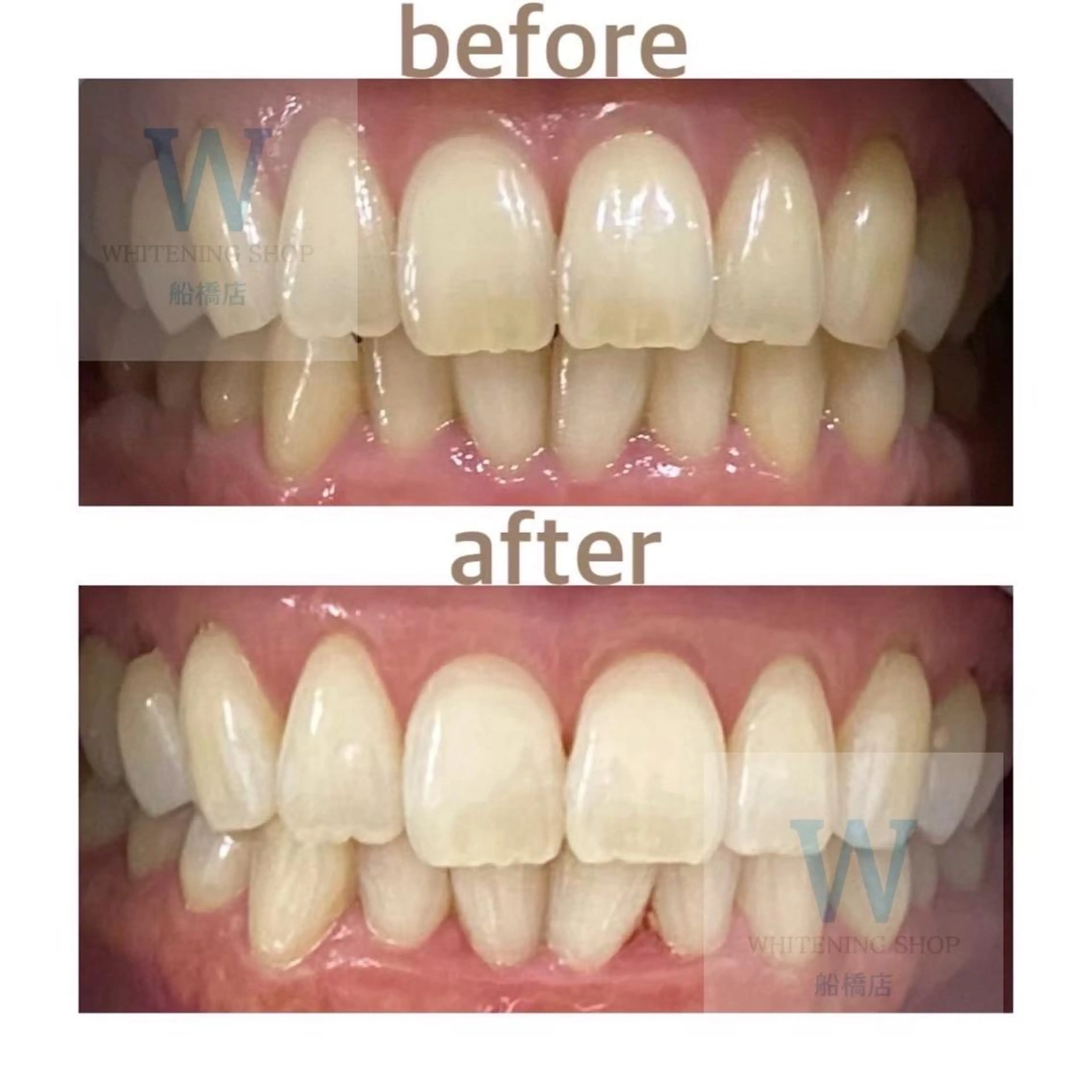 エステ リラク ホワイトニング ショップ船橋２号店のエステ・リラクイメージ