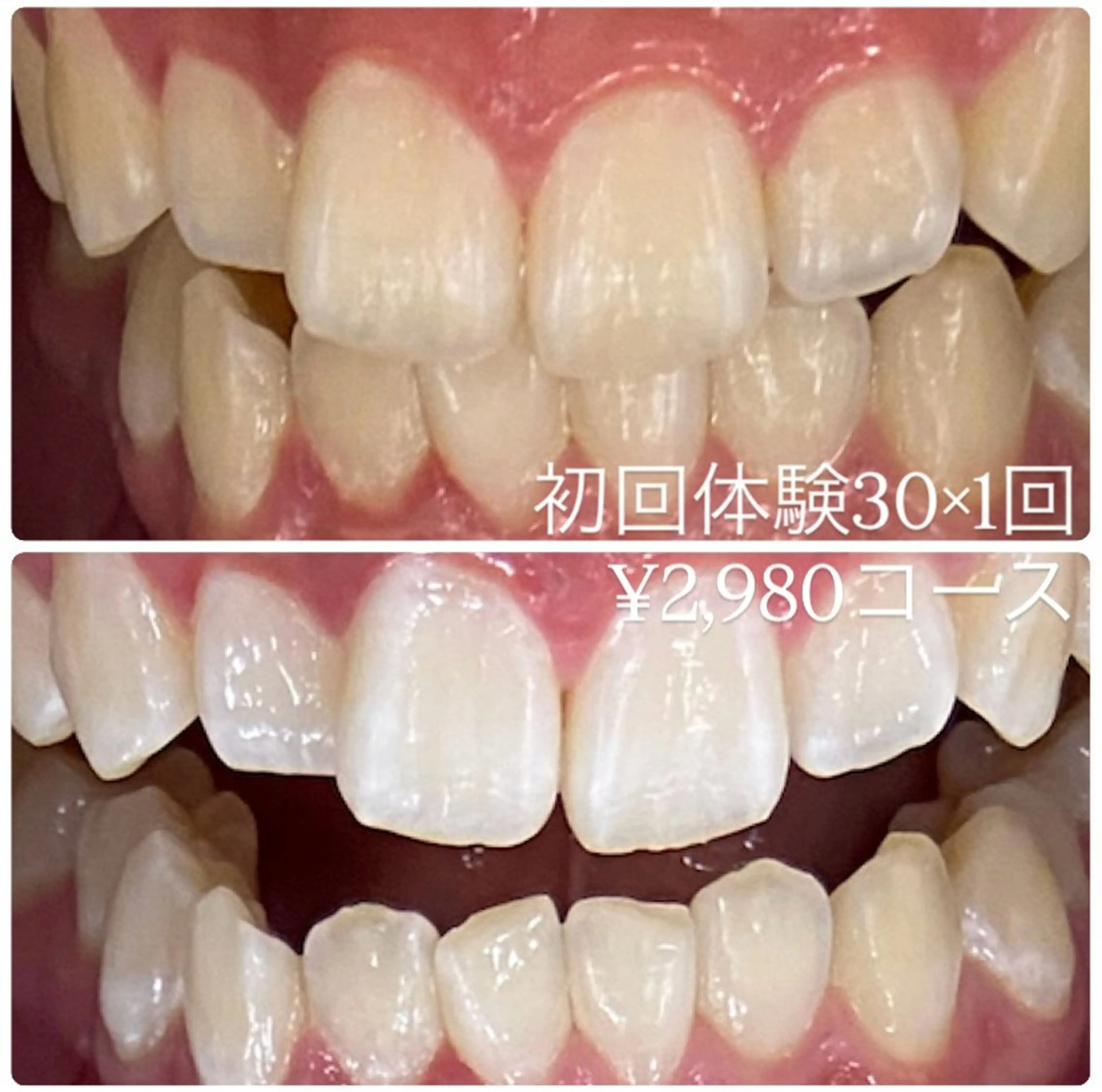 ホワイトニングルーム 横浜店のその他イメージ