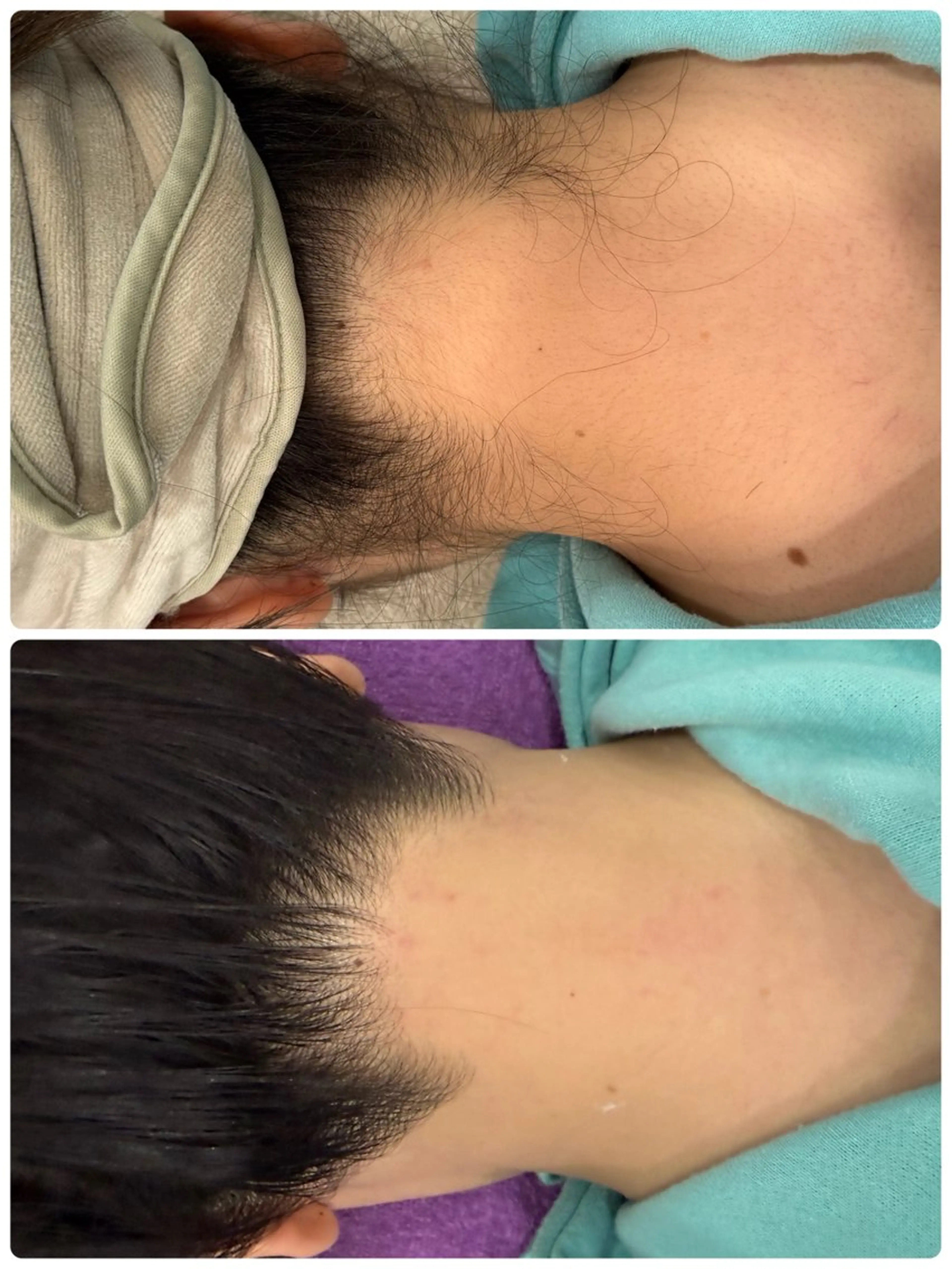 〈ちょっとしたおしゃれや！夏の準備に！〉うなじワックスの写真