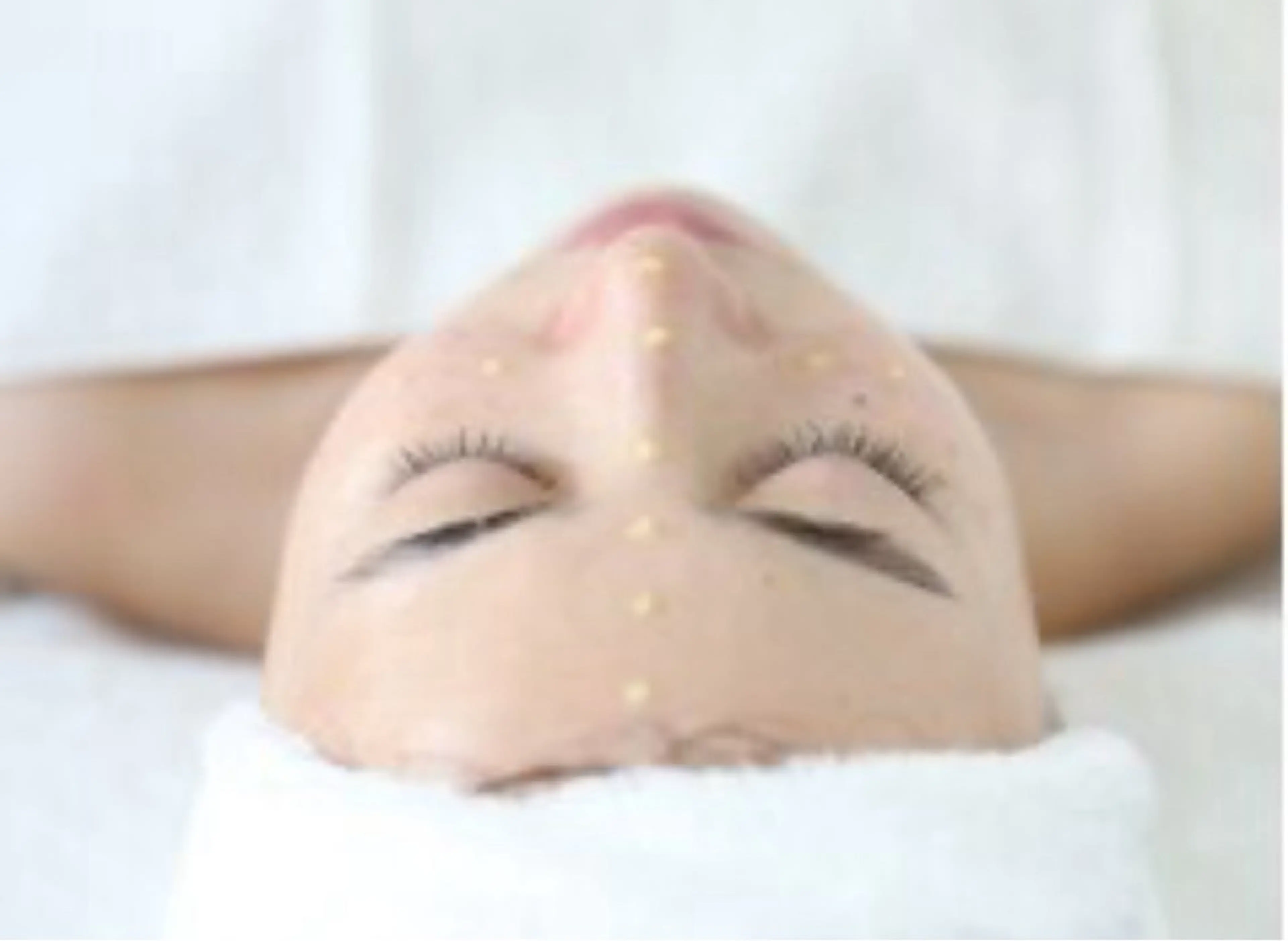 ◎研修生対応◎【深刻な黒ずみ改善】毛穴洗浄×マイクロニードルピーリングの写真