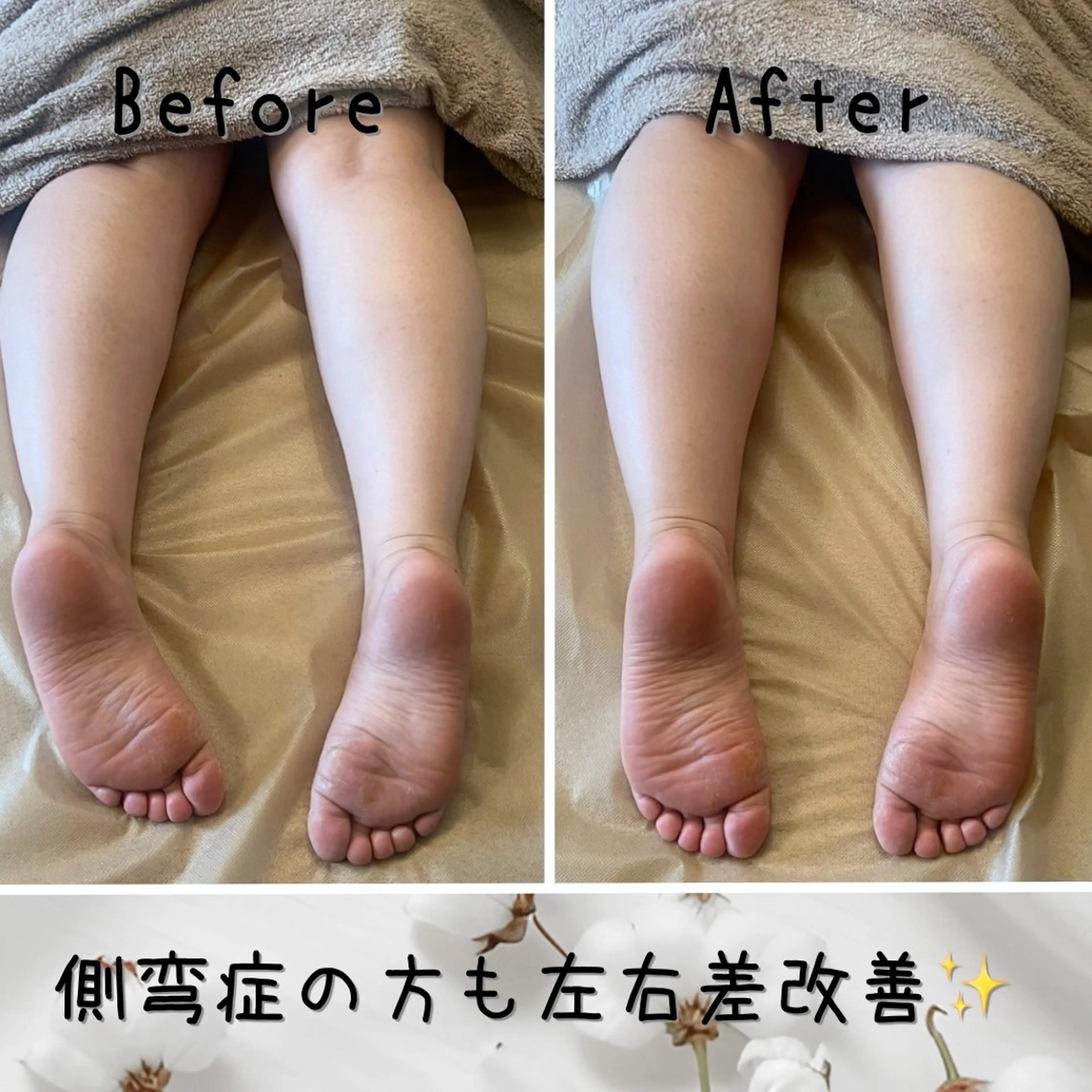 【🎉🫶ご新規様限定＋口コミ割🫶🎉】背骨/骨盤矯正＋アロマリンパマッサージ90分の写真