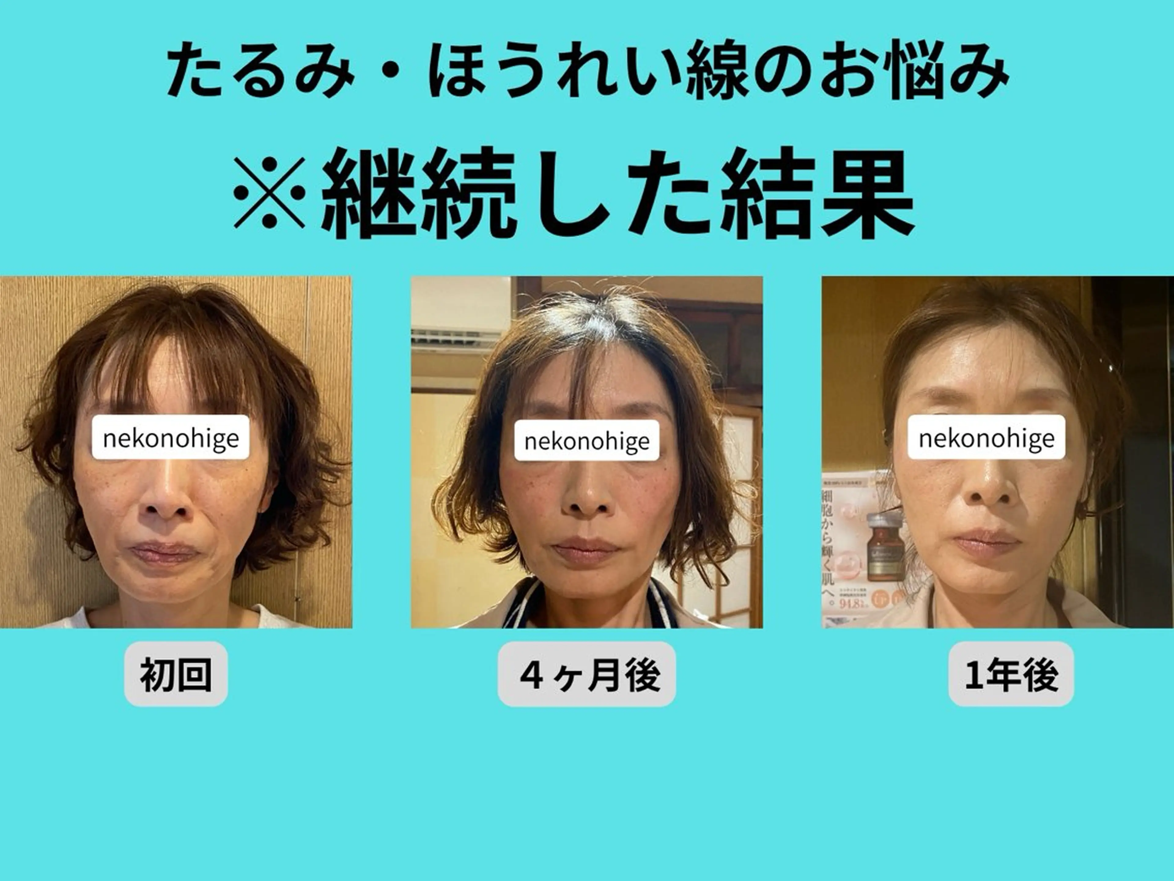 美容鍼灸サロンねこのひげ所属・池上 猛のその他イメージ