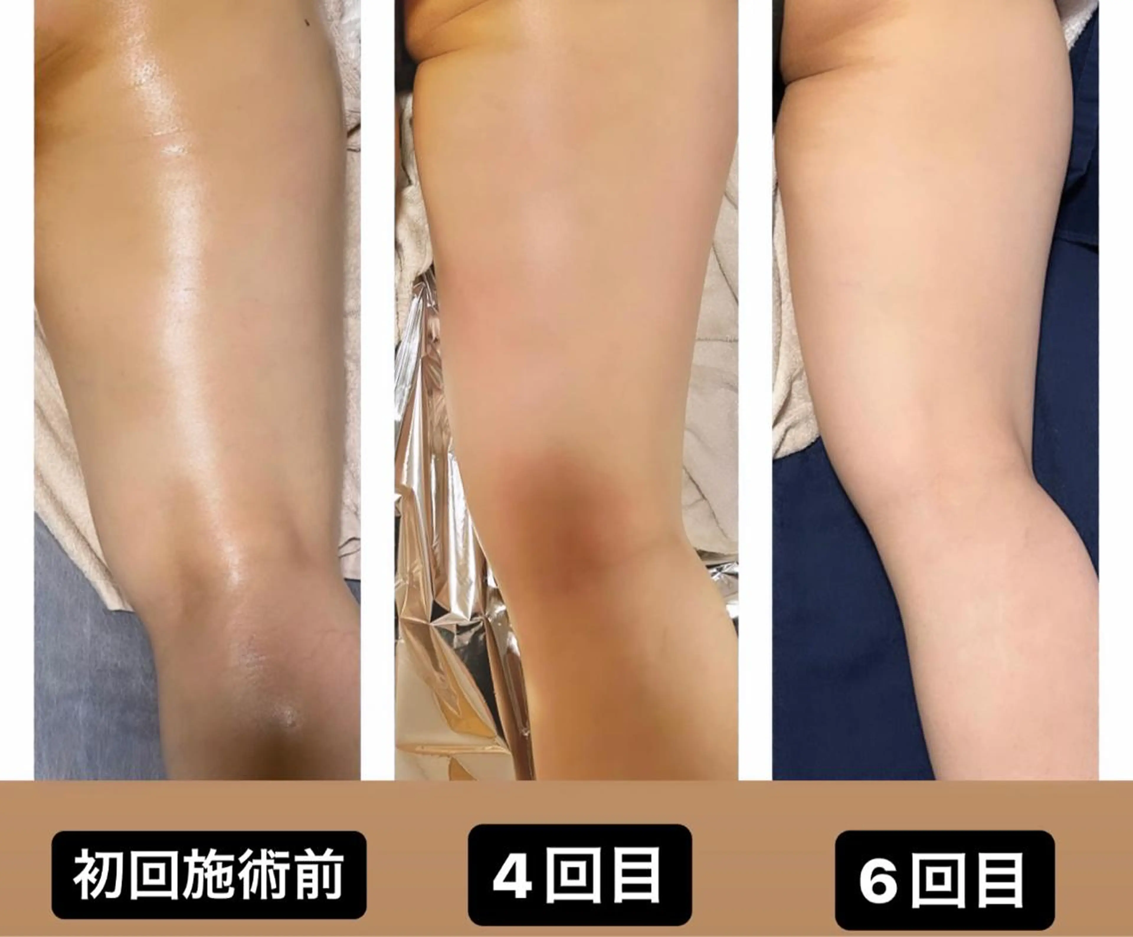 🌴Beauty Salon LANAのエステ・リラクイメージ