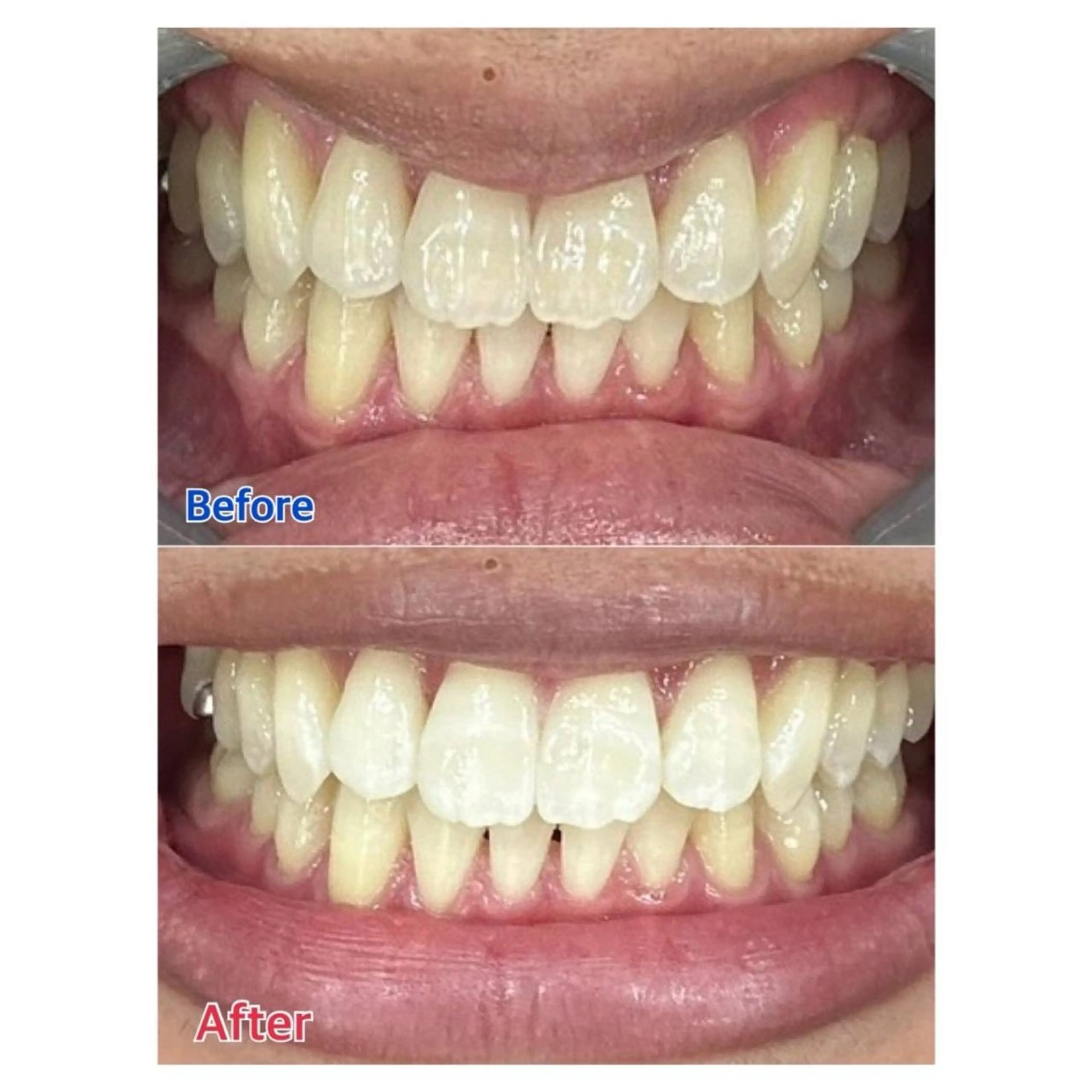 Melty 輝のその他イメージ