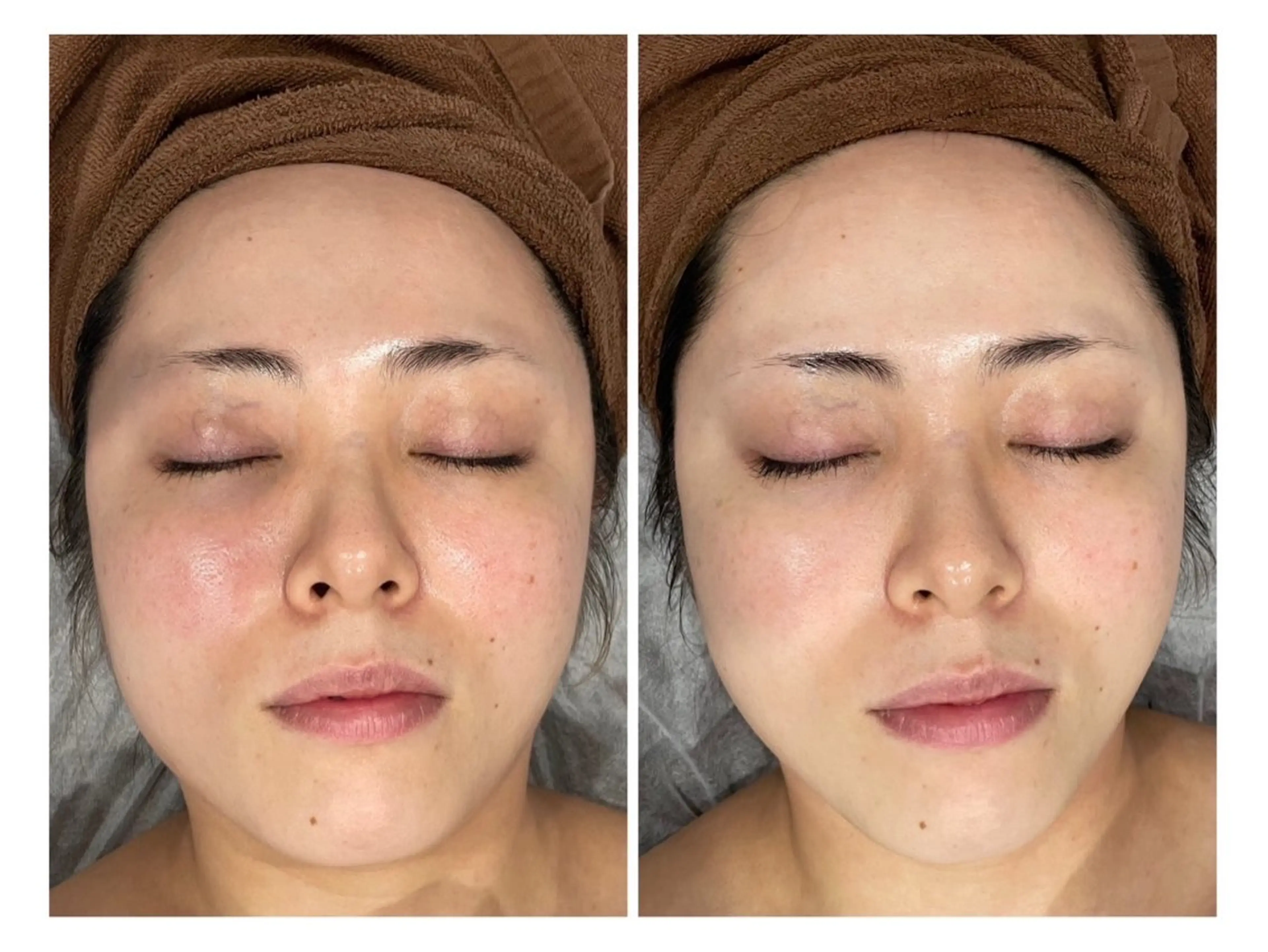 【新規女性/くすみが抜ける透明感ケア】ハリつや光フェイシャル体験¥6600の写真