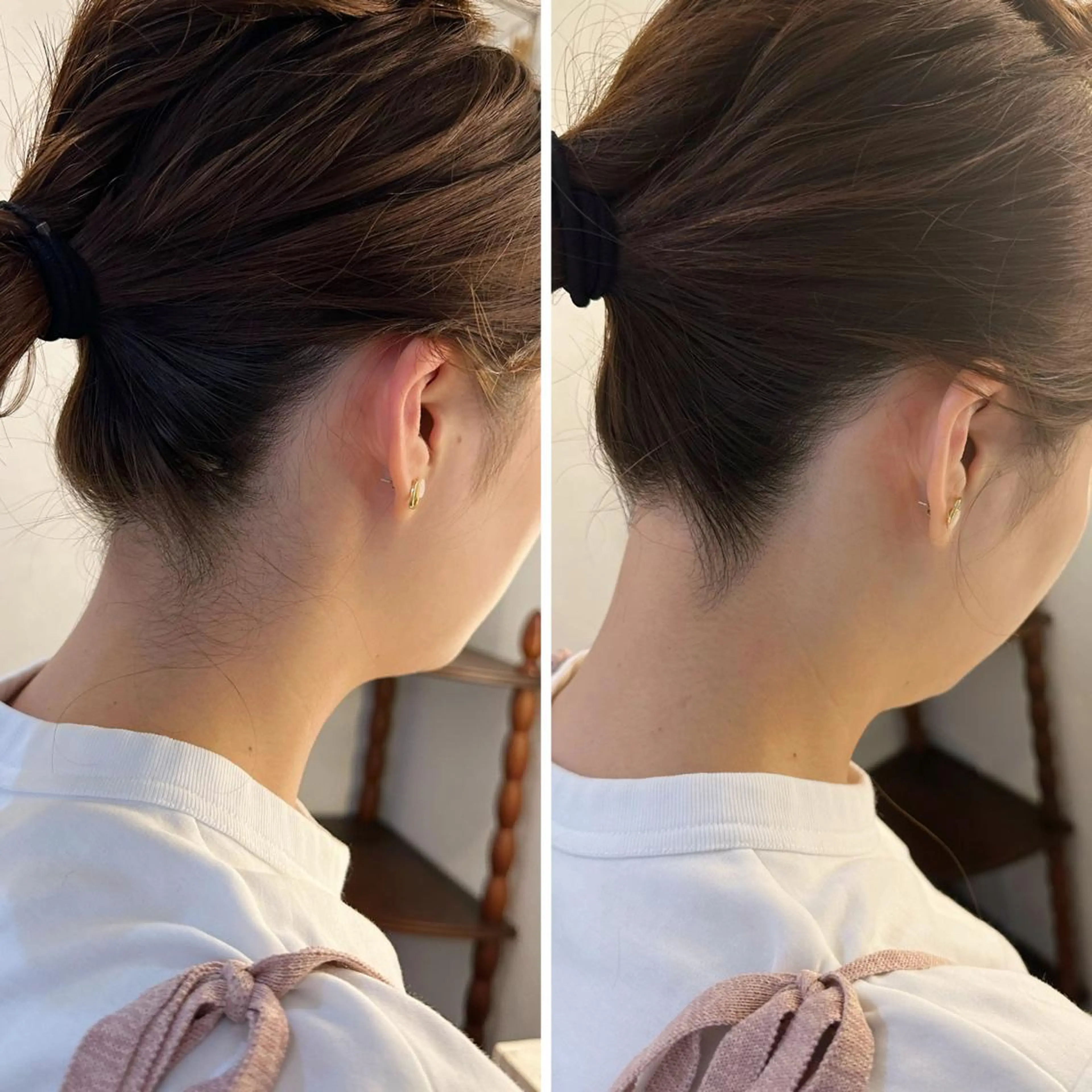 脱毛 うなじ脱毛/美肌脱毛 LABELのエステ・リラクイメージ