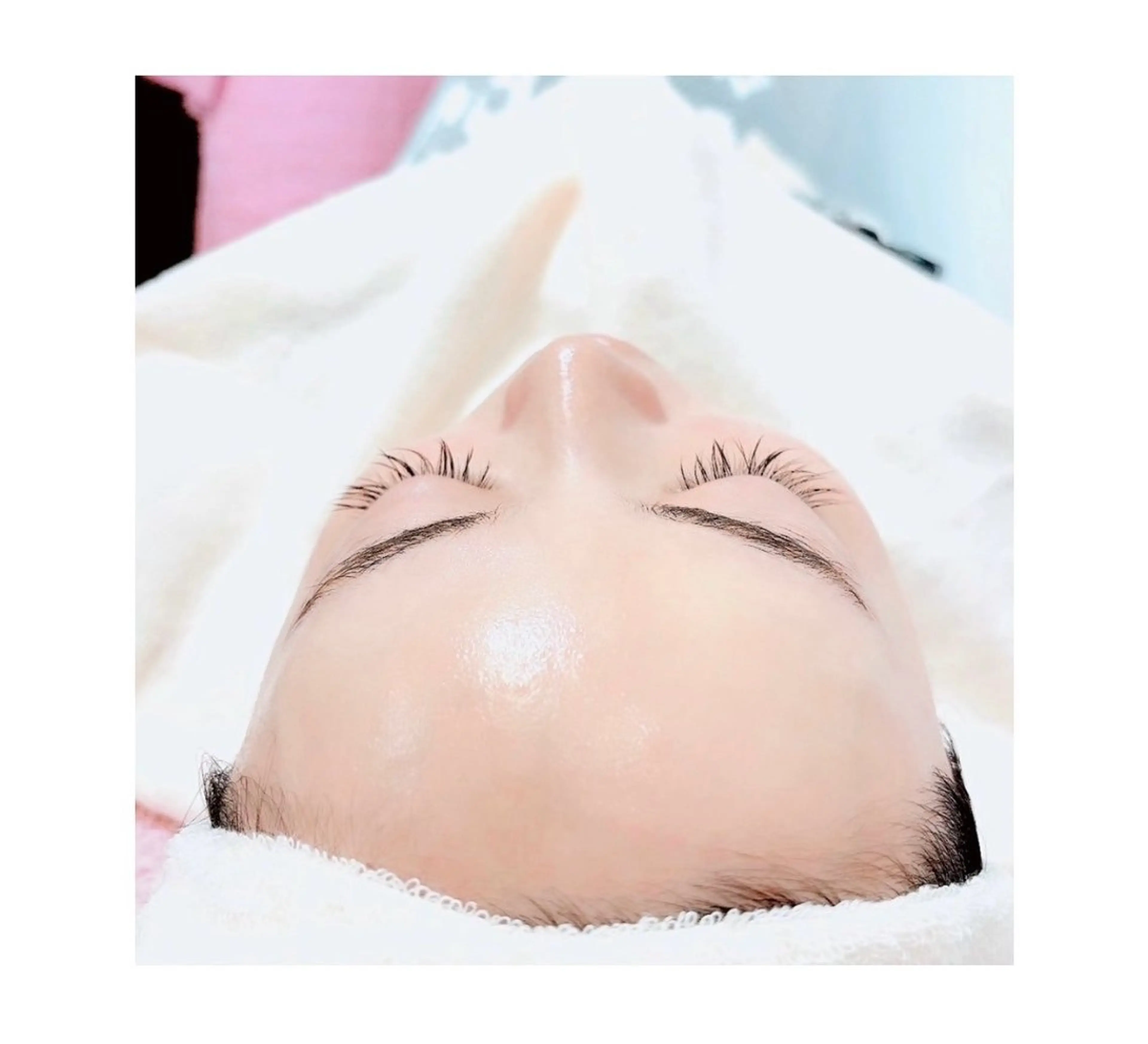 本気のツヤ肌☆WiQoワイコ水光ピール60minの写真