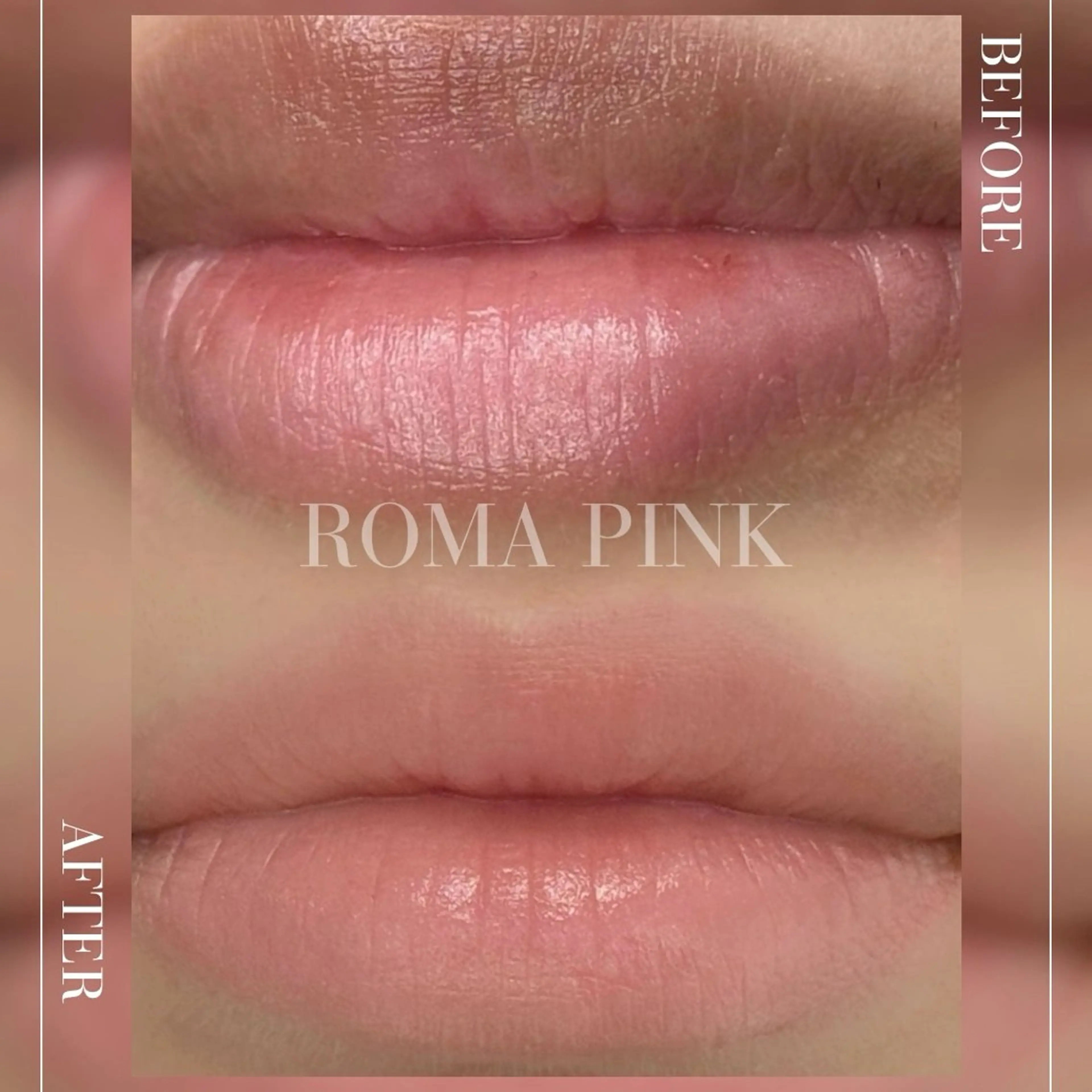 韓国美容【ローマピンク　リップ】の写真