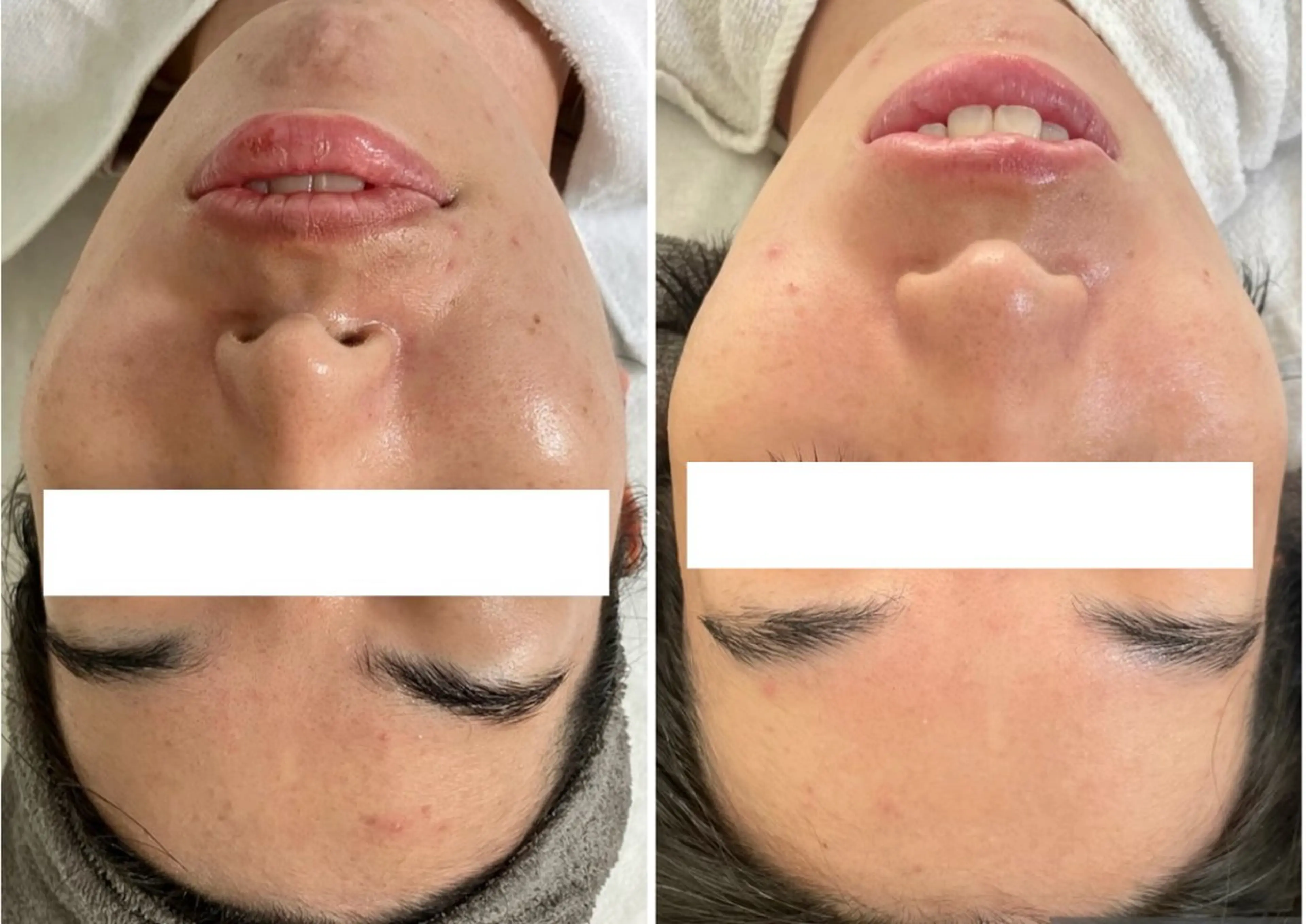 Miroire ミロワールのエステ・リラクイメージ