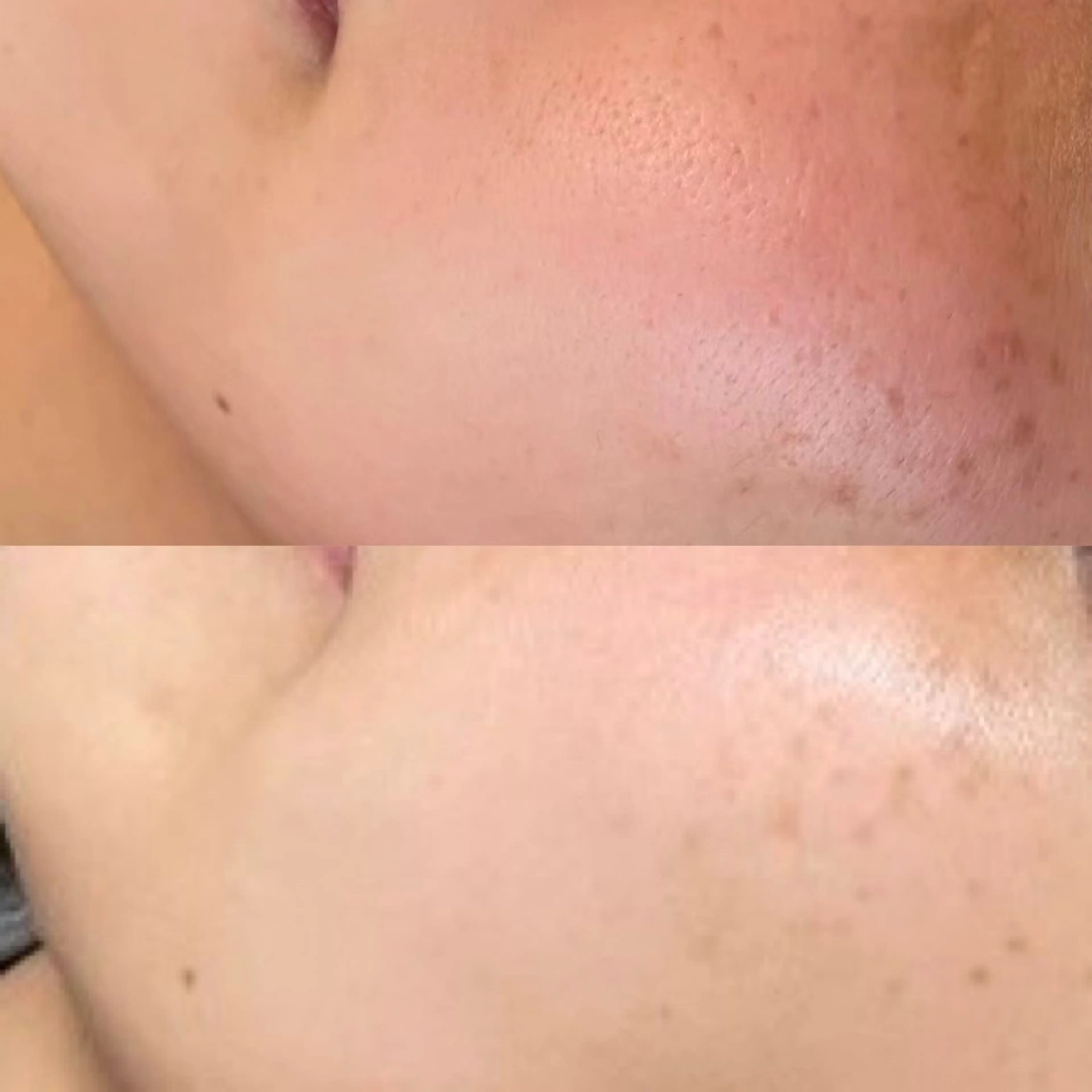 エステ シミケア専門サロン Linoのエステ・リラクイメージ