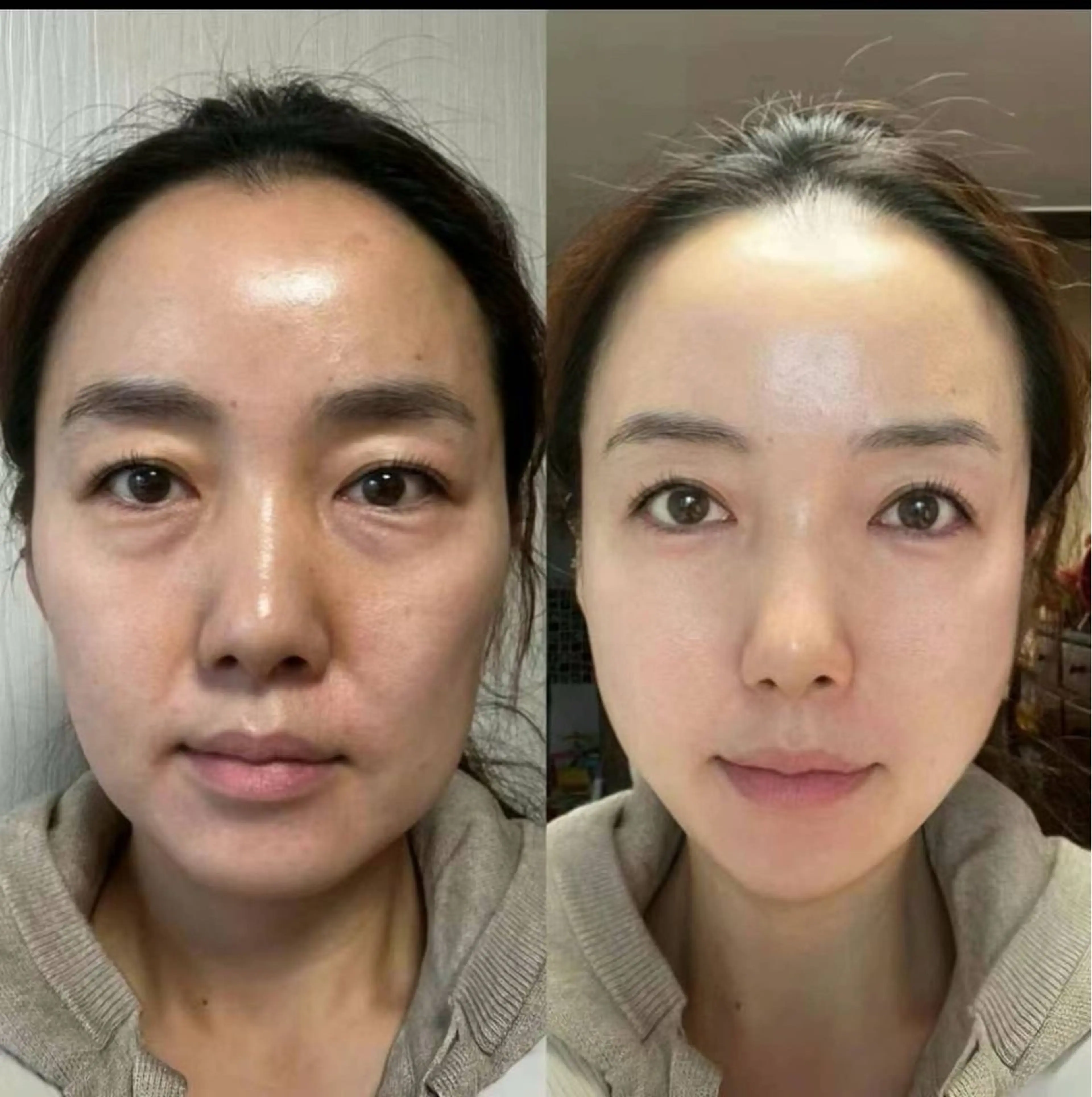 ネイル エステ aliaハーブ水光店 エステティシャン募集のエステ・リラクイメージ