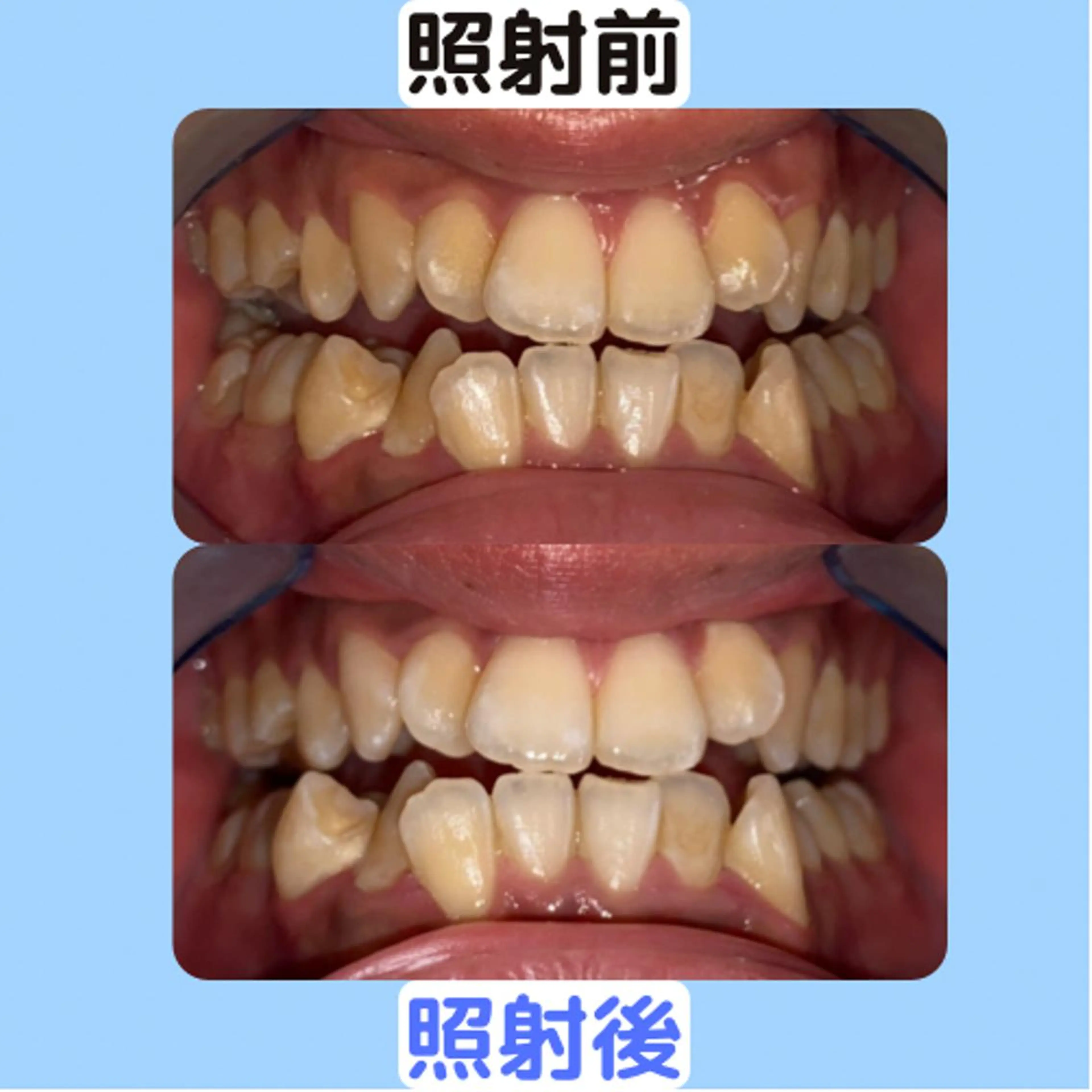 韓国式3D毛穴洗浄 lonhanaのその他イメージ