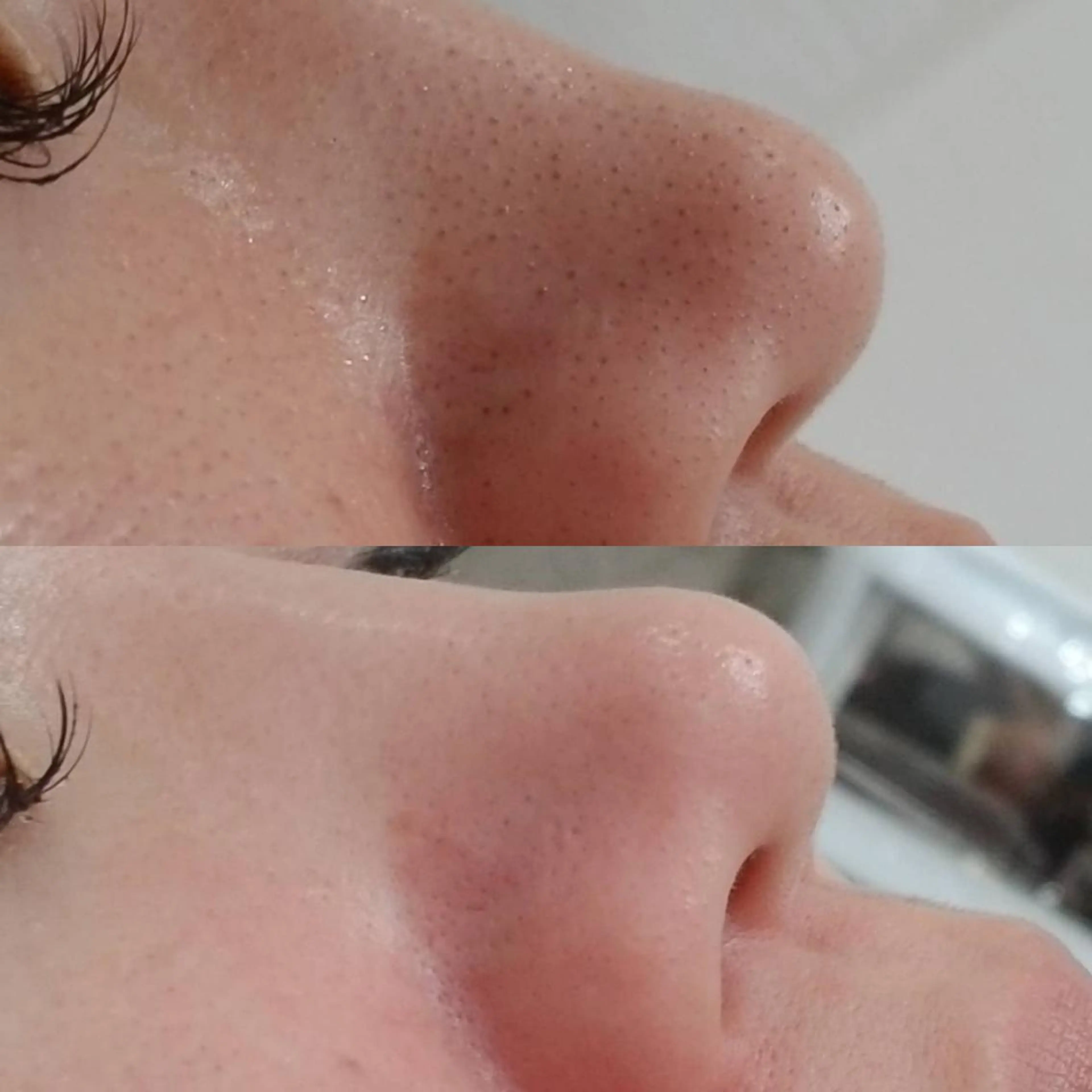 エステ 美肌脱毛&毛穴専門 Anaciaのエステ・リラクイメージ