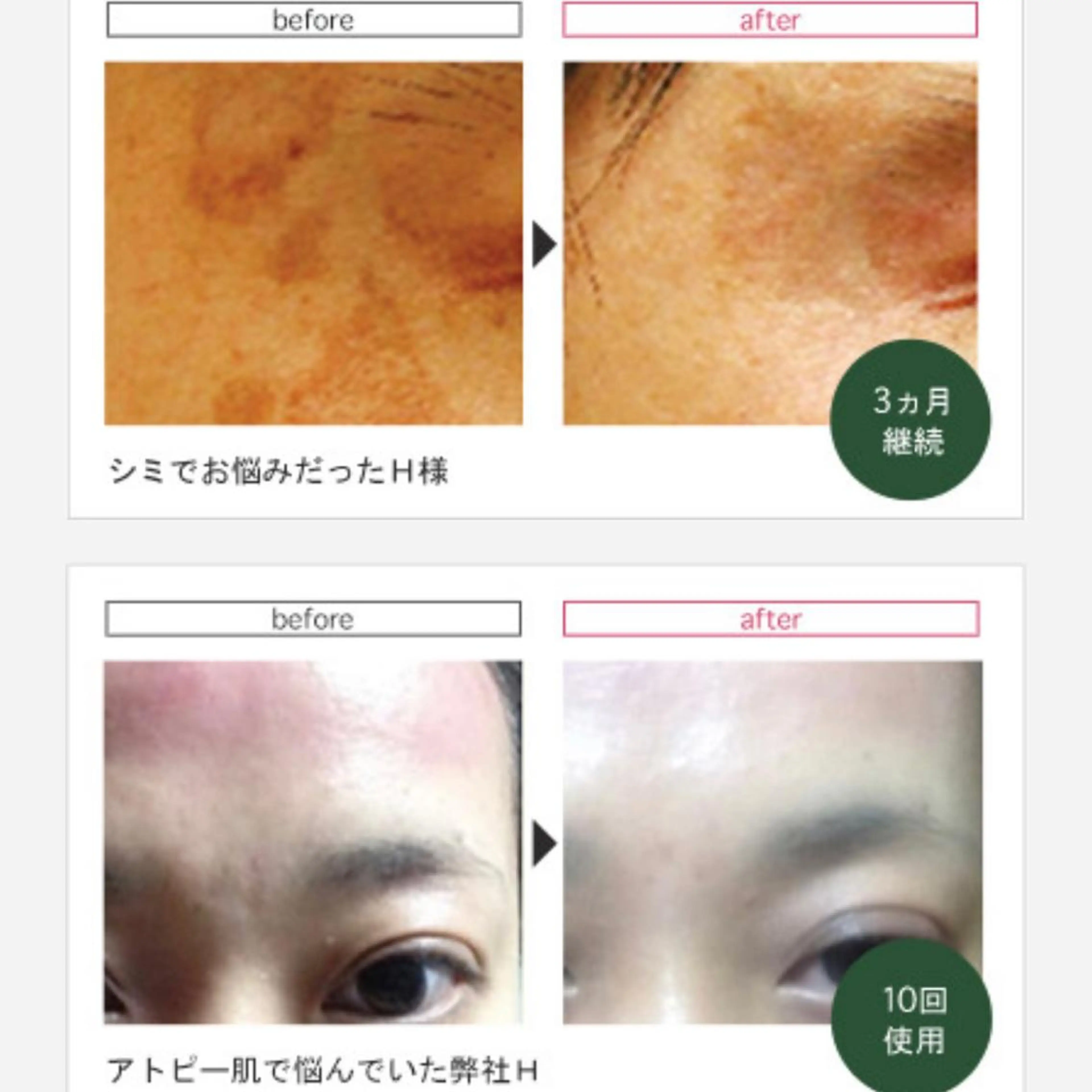 LEA MUSASHIKOSUGI所属・美肌育成サロン LEA武蔵小杉のエステ・リラクイメージ