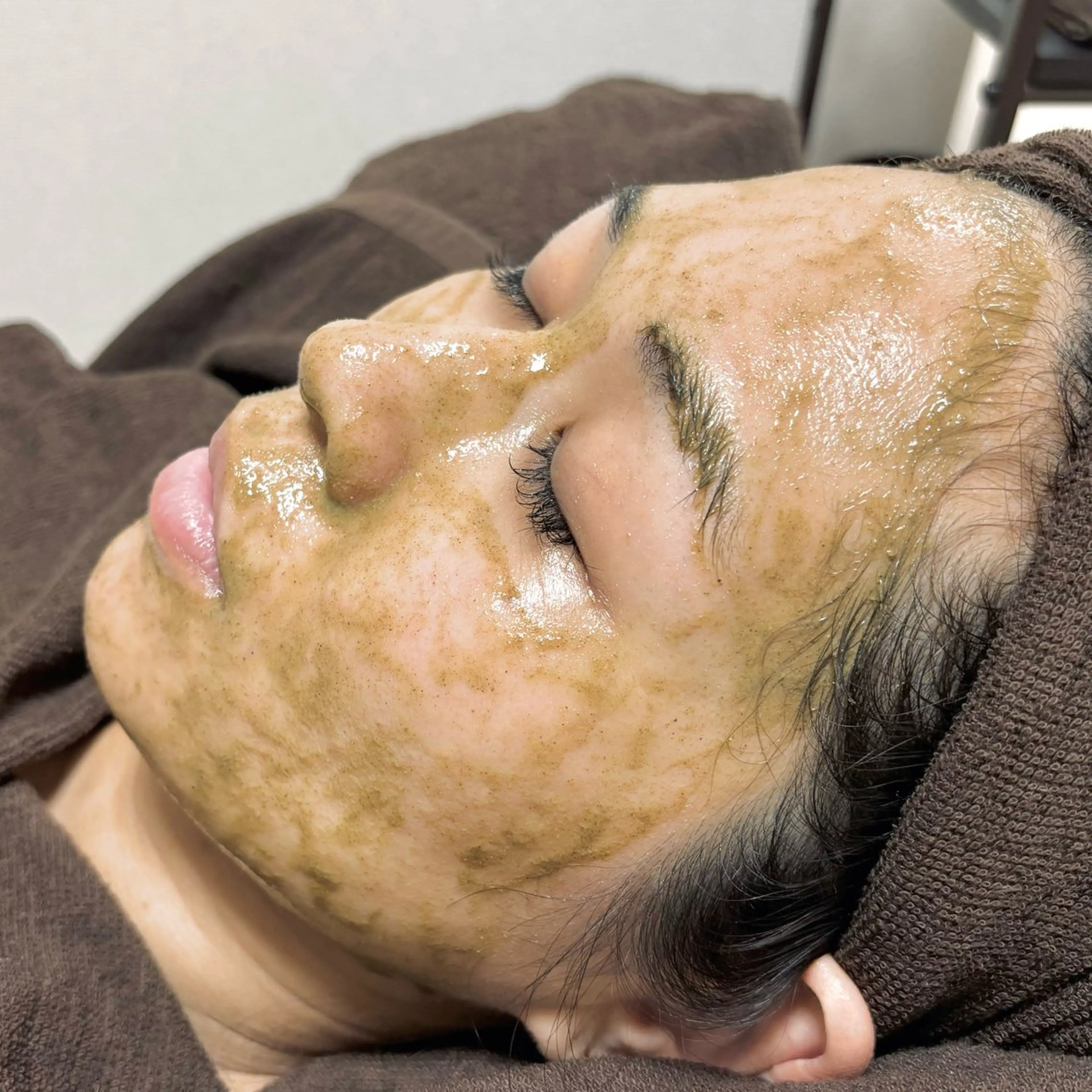 ミニモ限定🫧《剥離なし》ハーブピーリング🌿‬低刺激で痛くない🩵ダウンタイムなし‎🪞メンズも歓迎🕊の写真