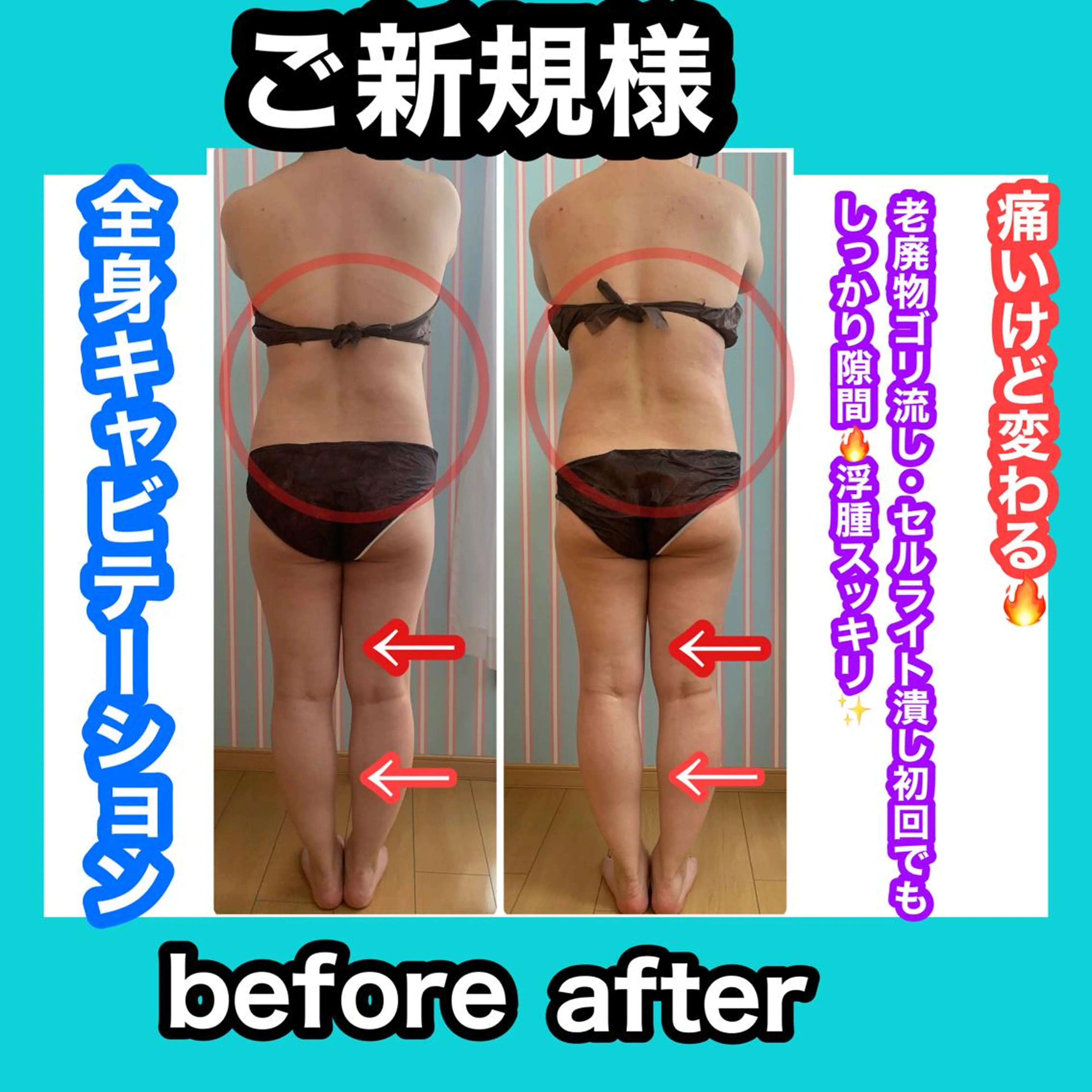 エステ リラク 痩身/脱毛/ネイル HARUKAのエステ・リラクイメージ