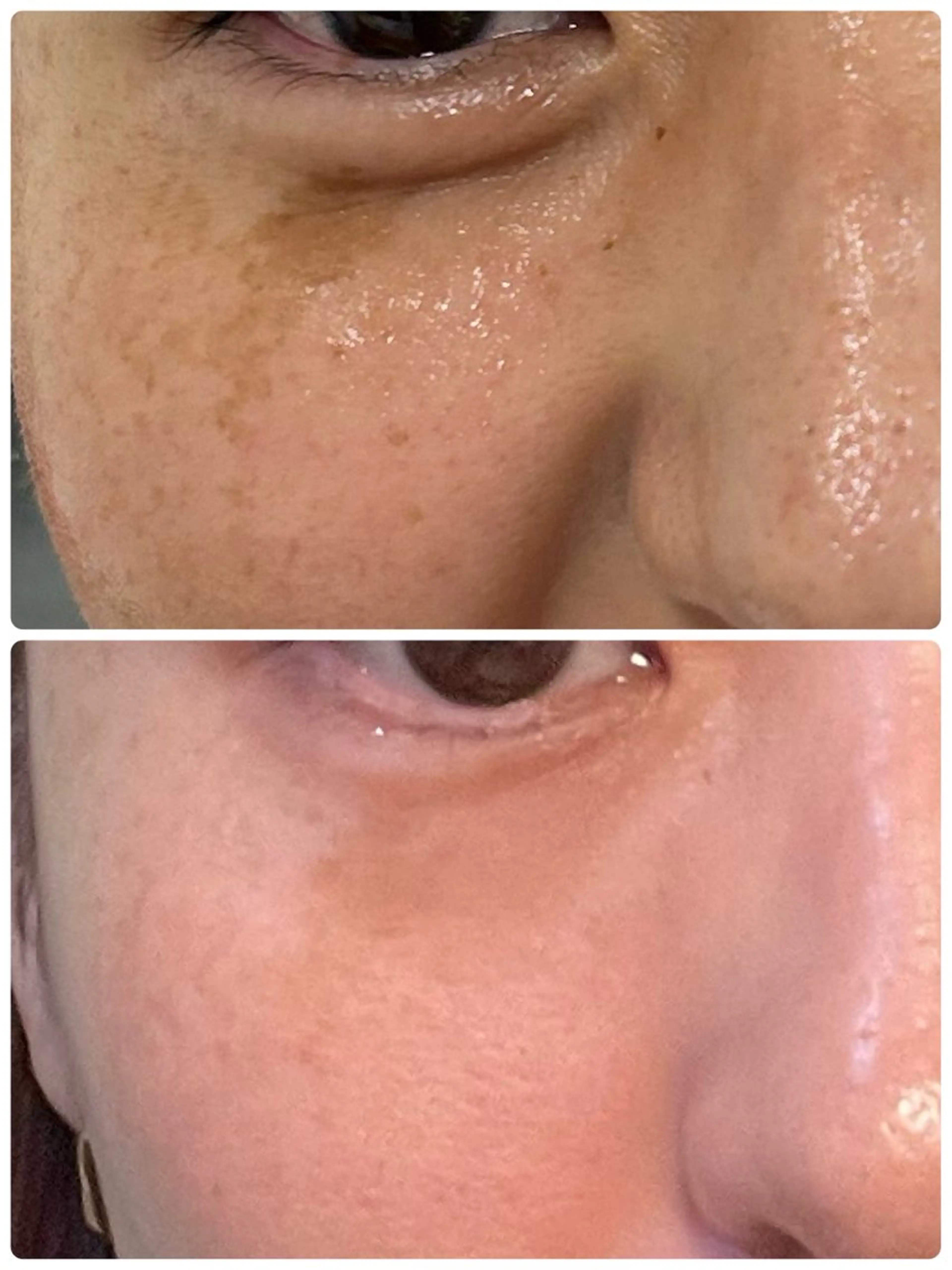 エステ Sena Dewi SAE🌼のその他イメージ