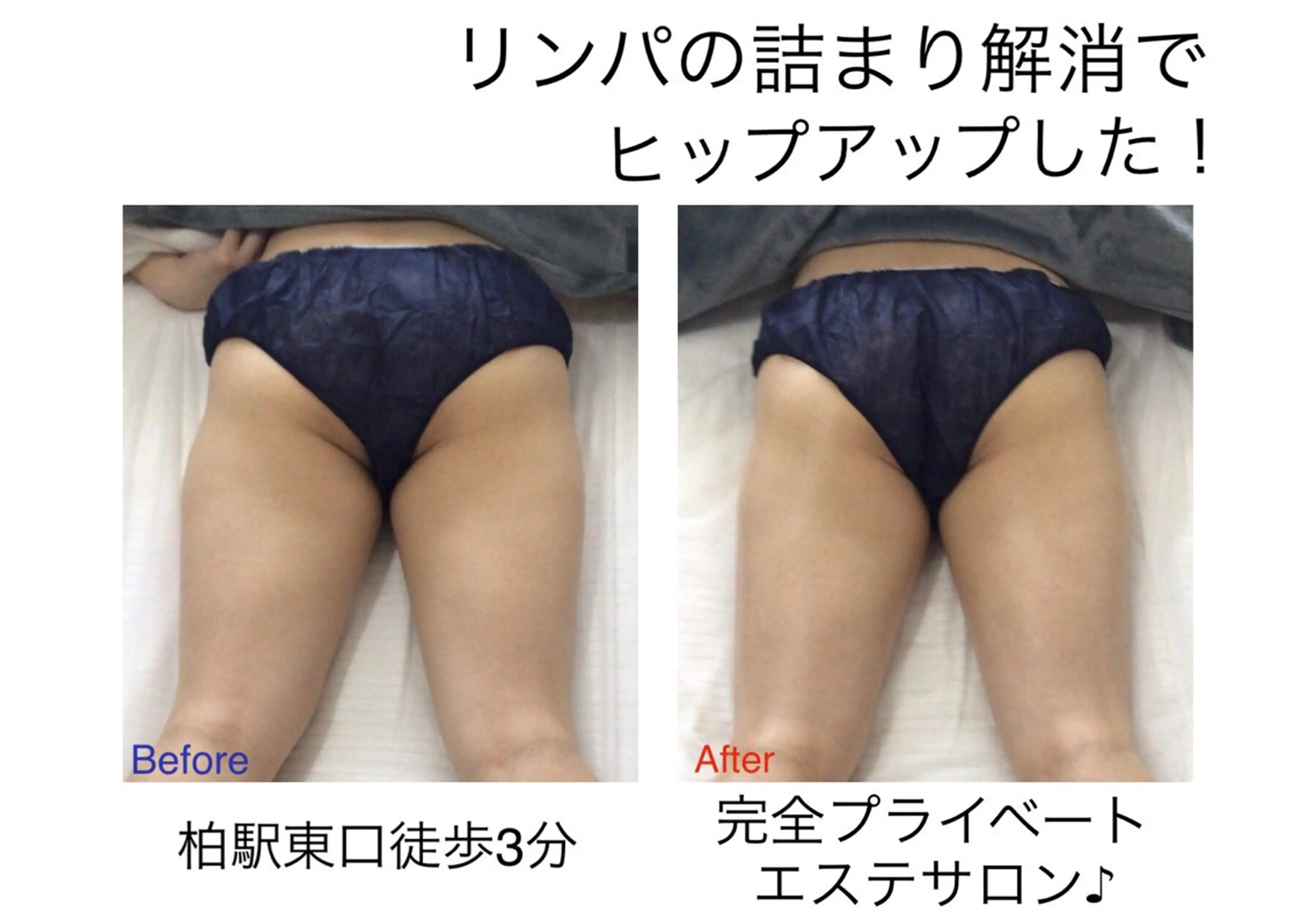 子宮矯正/腸揉み/ シュガーリング脱毛のエステ・リラクイメージ