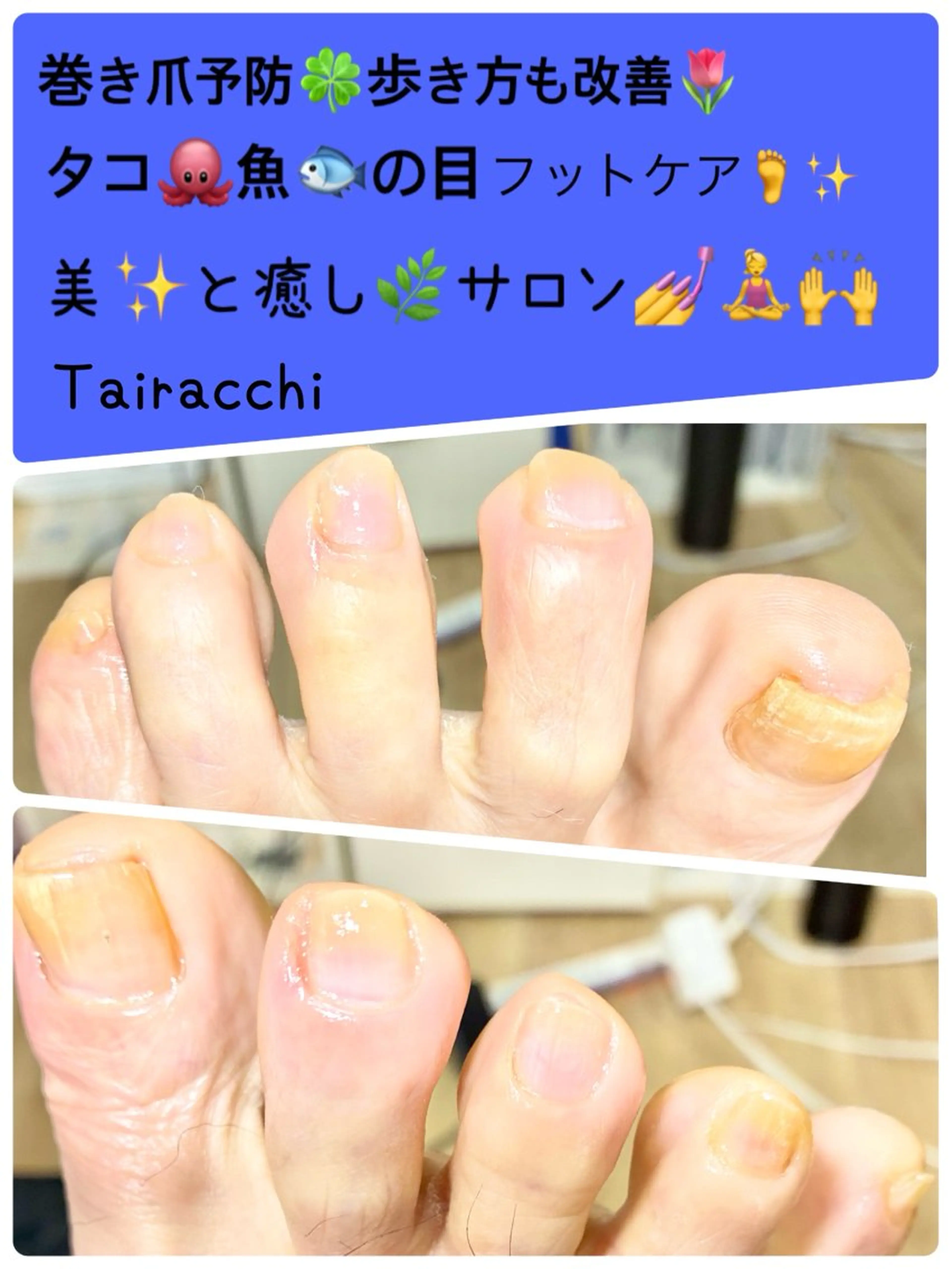 ネイル フットネイル フットネイル Tairacchi ﾀｲﾗｯﾁのエステ・リラクイメージ