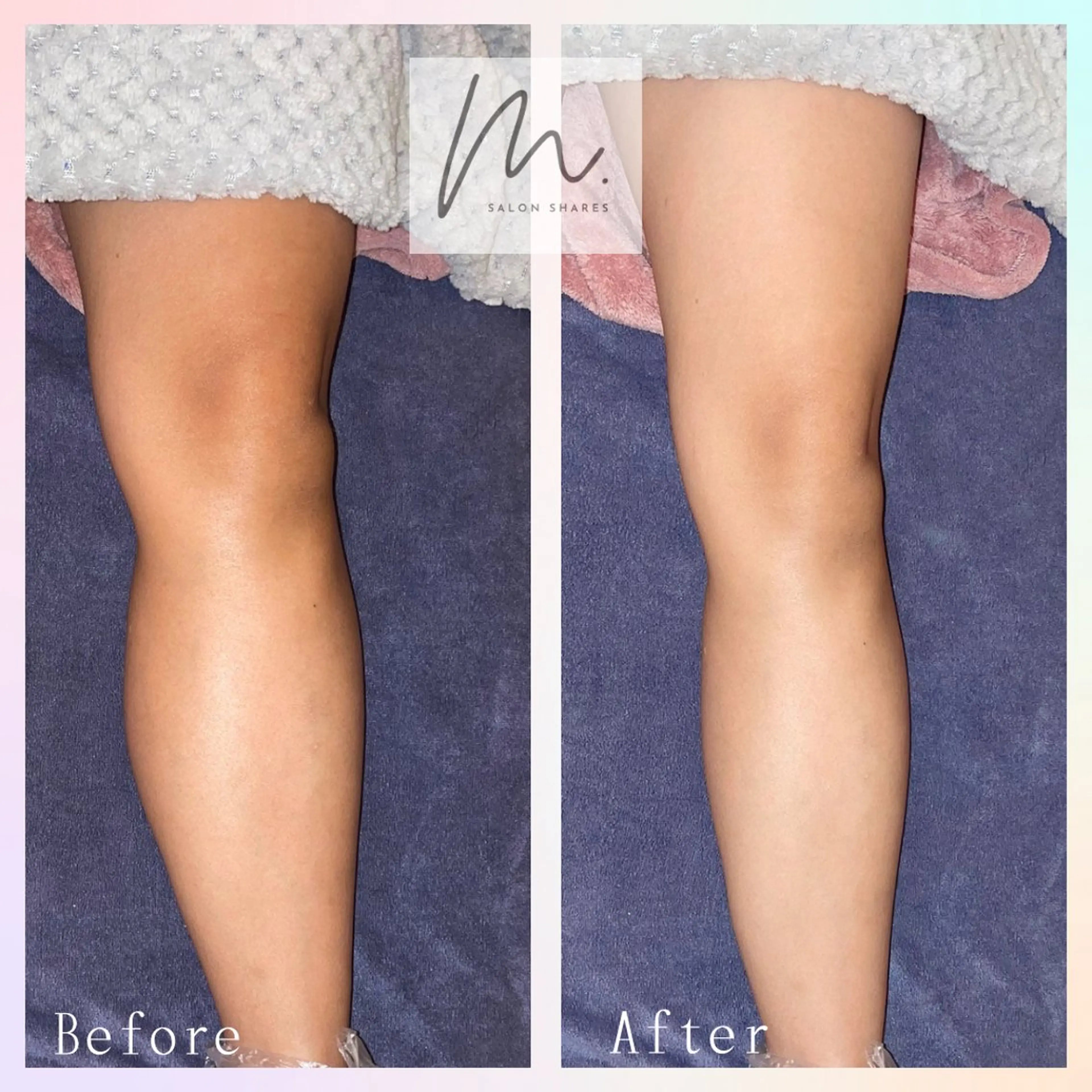 SHARES MADOKAのエステ・リラクイメージ