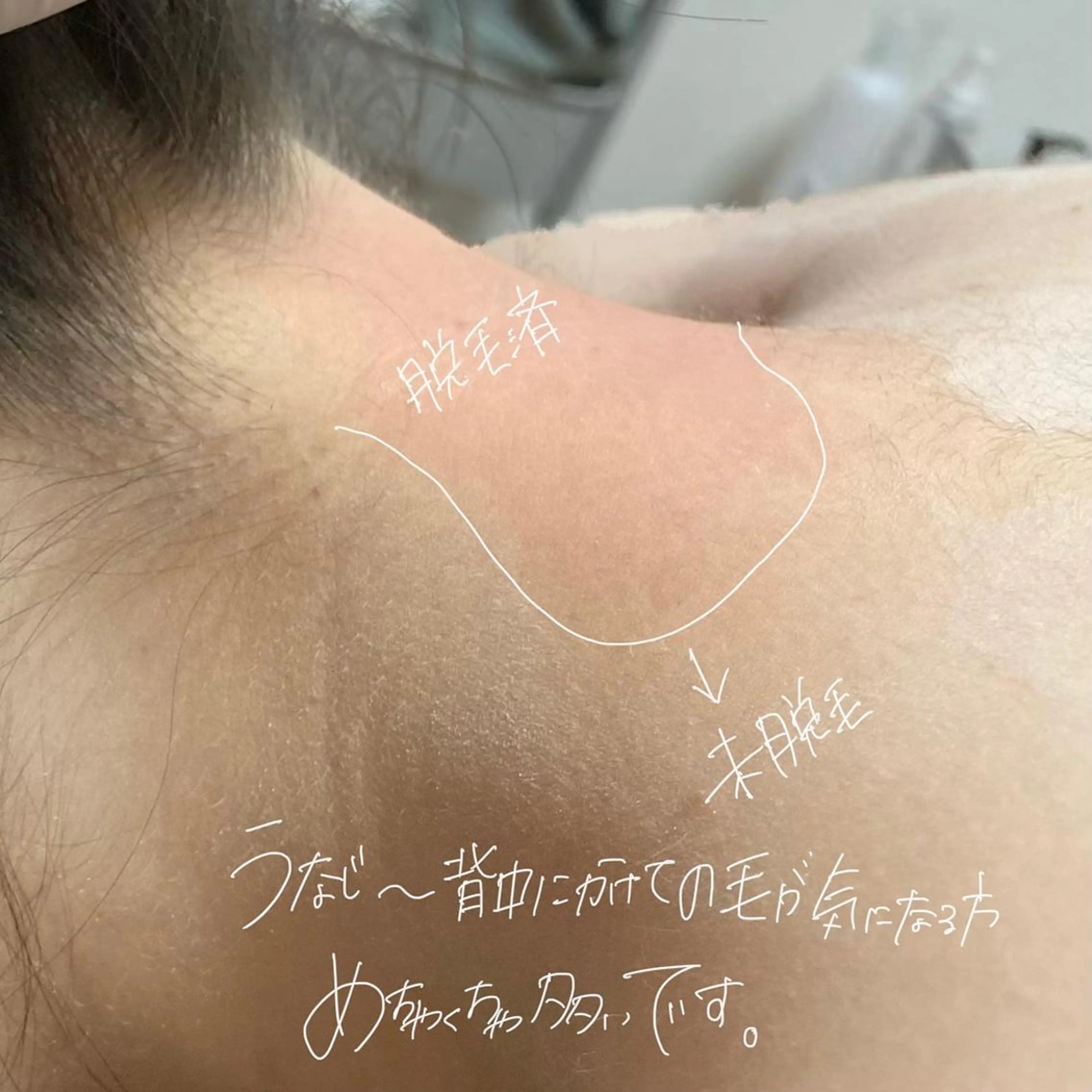 脱毛 Ohata Megumiの眉毛・アイブロウイメージ