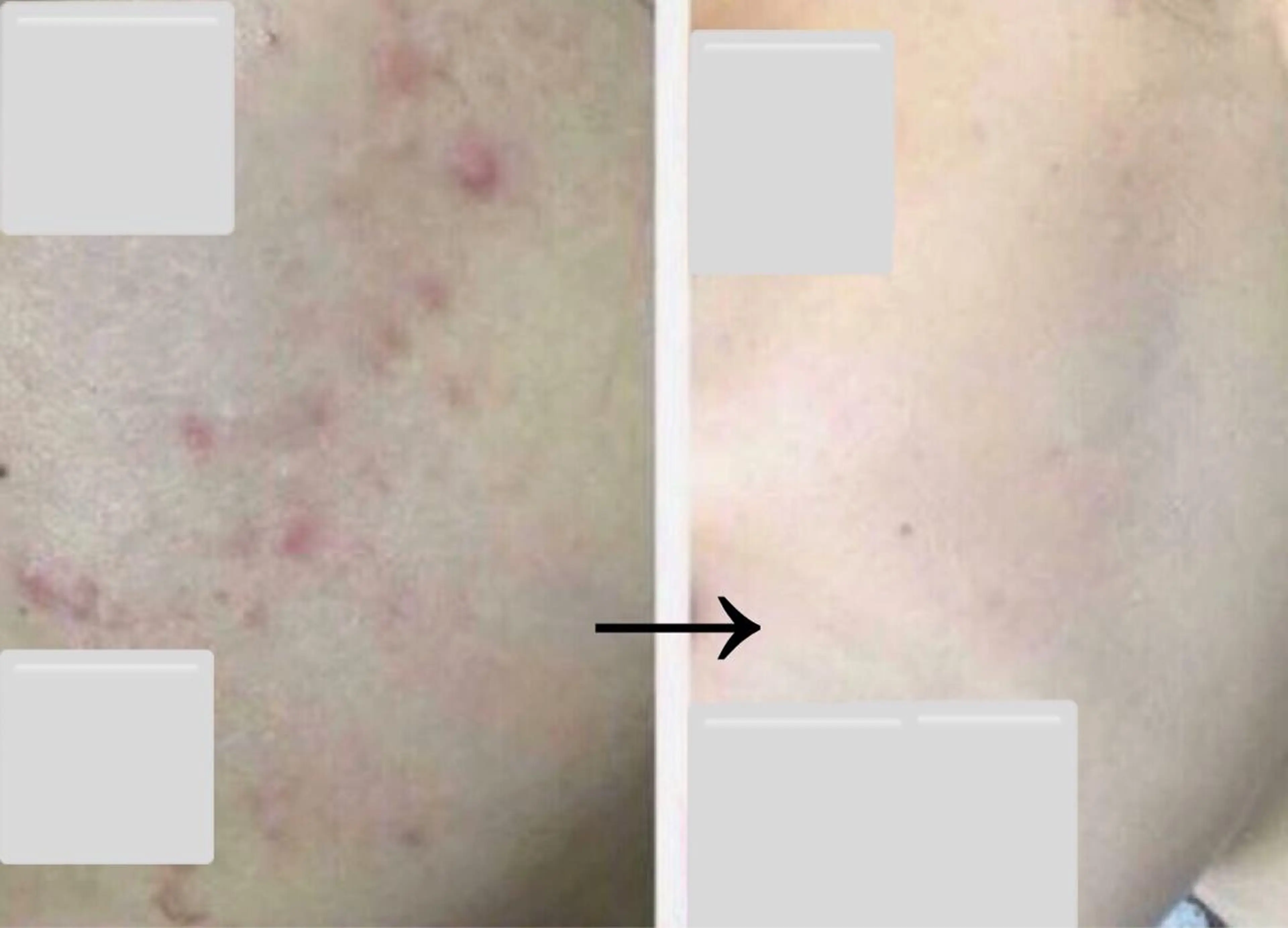 自爪育成ネイルサロン ココリュバンのネイルデザイン