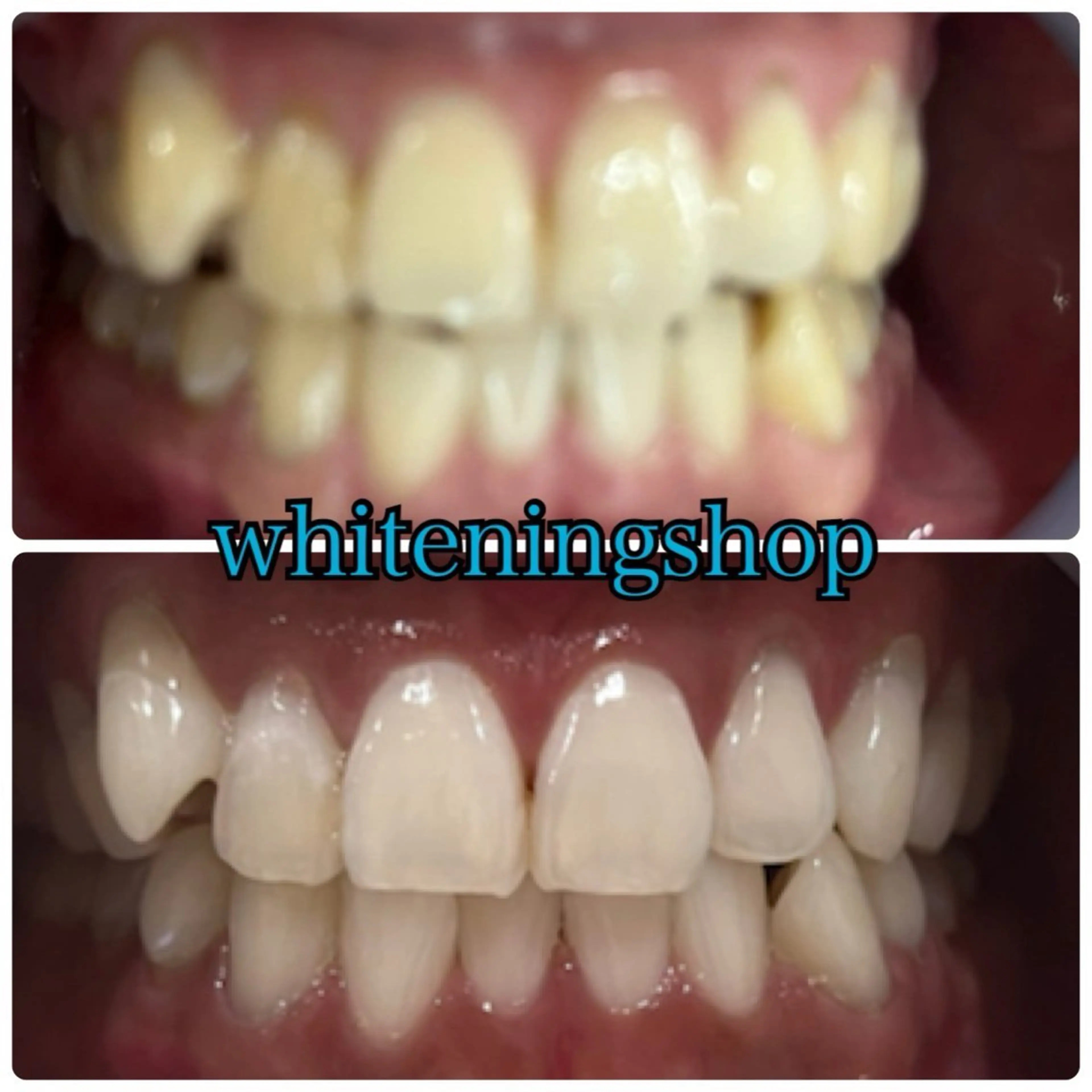 メンズ ホワイトニング ショップ川越店のエステ・リラクイメージ