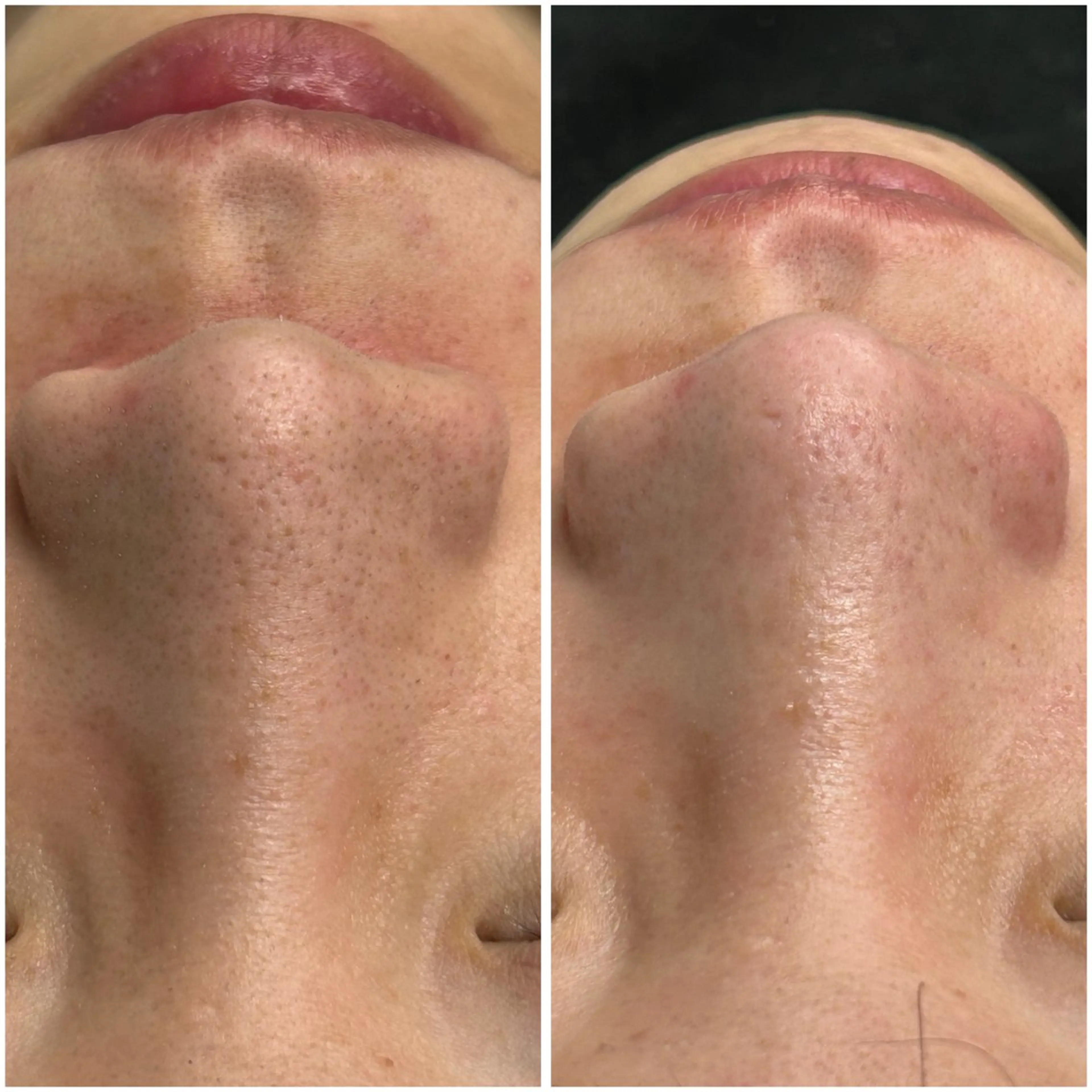 re.make所属・小顔美肌💖痩身☃️ ユキナ🤍のエステ・リラクイメージ