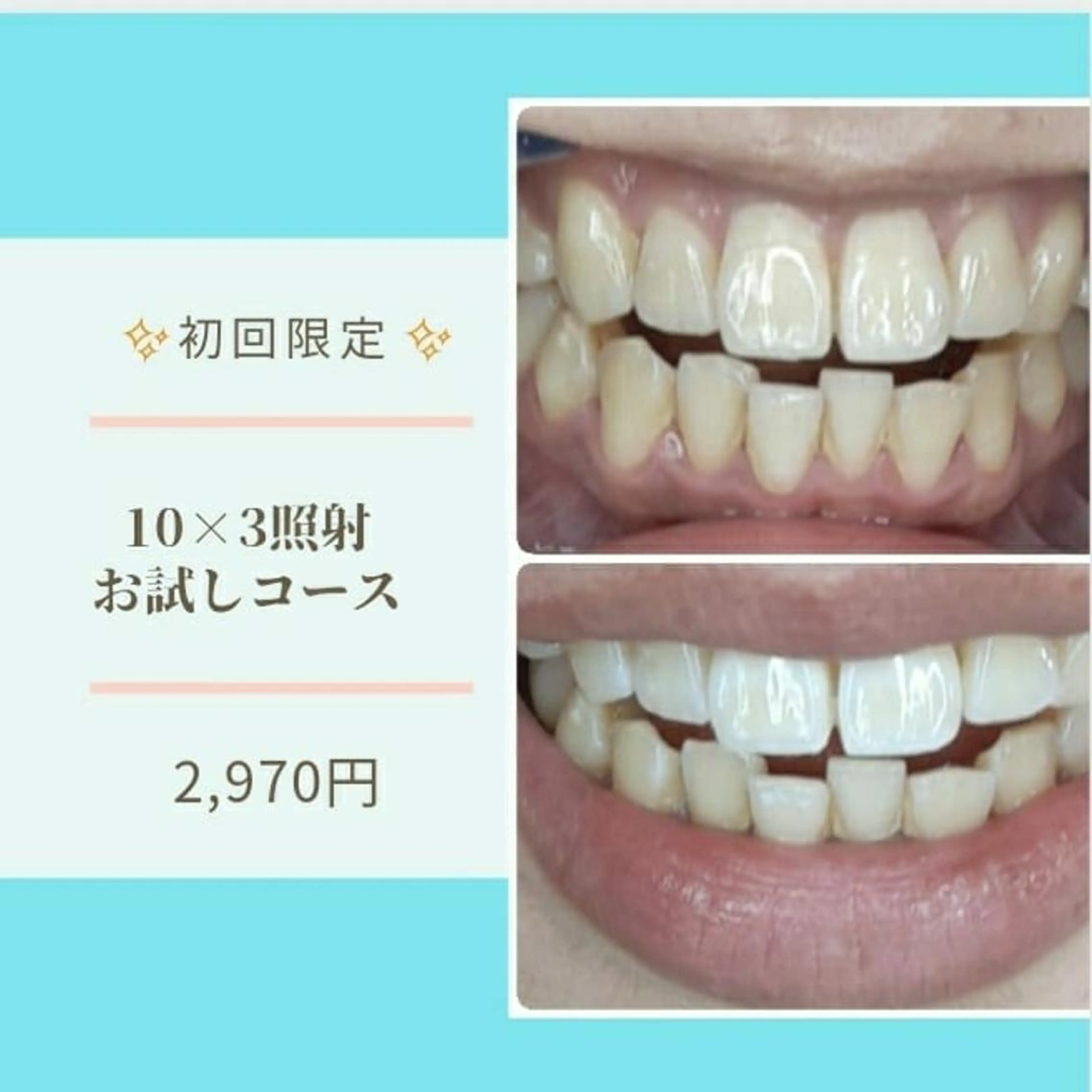 その他 五十嵐 蓮のその他イメージ