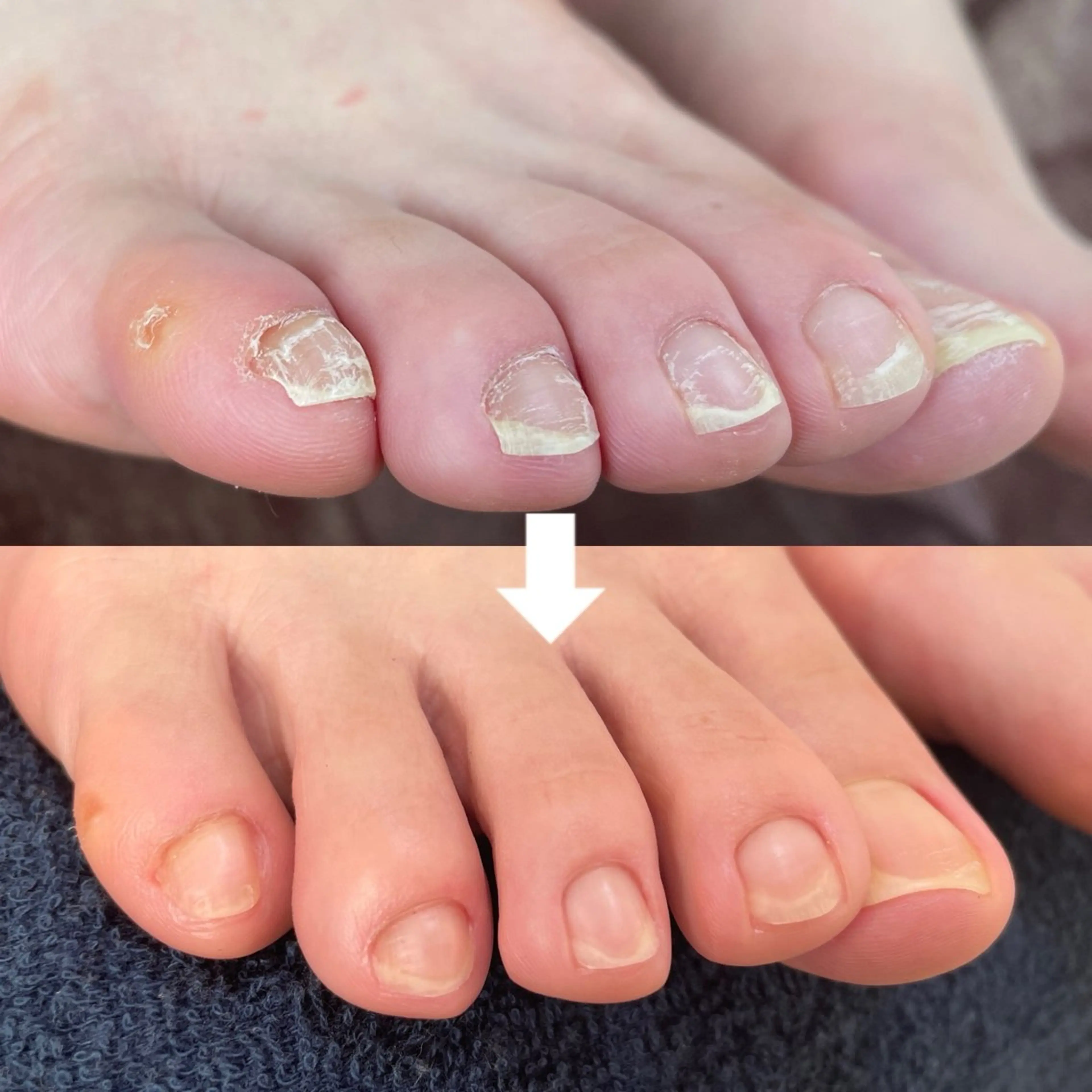 フットネイル たちばな ✋🦶💆‍♀️のネイルデザイン