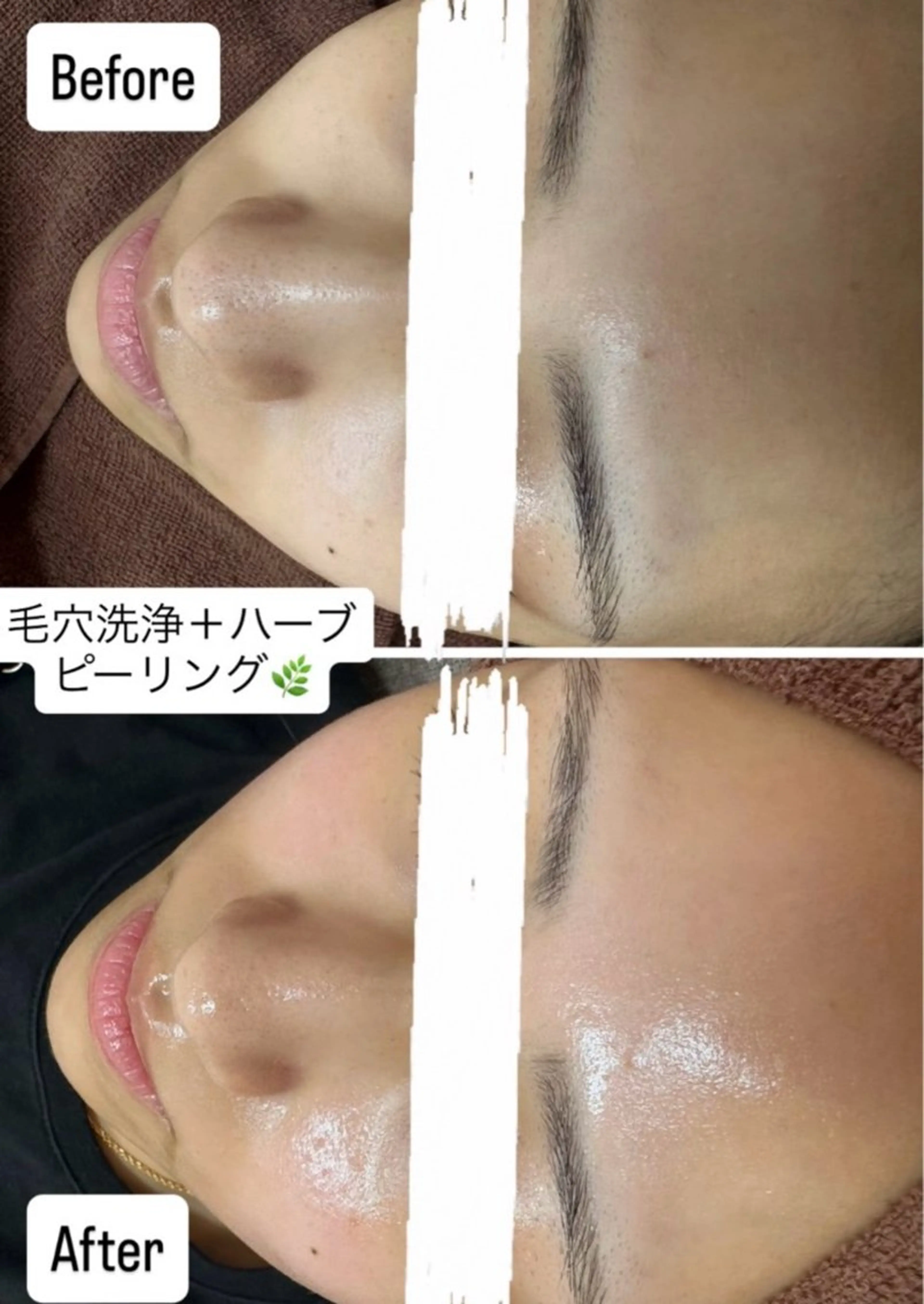 エステ 韓国肌管理×毛穴 改善専門🤍nanaのエステ・リラクイメージ