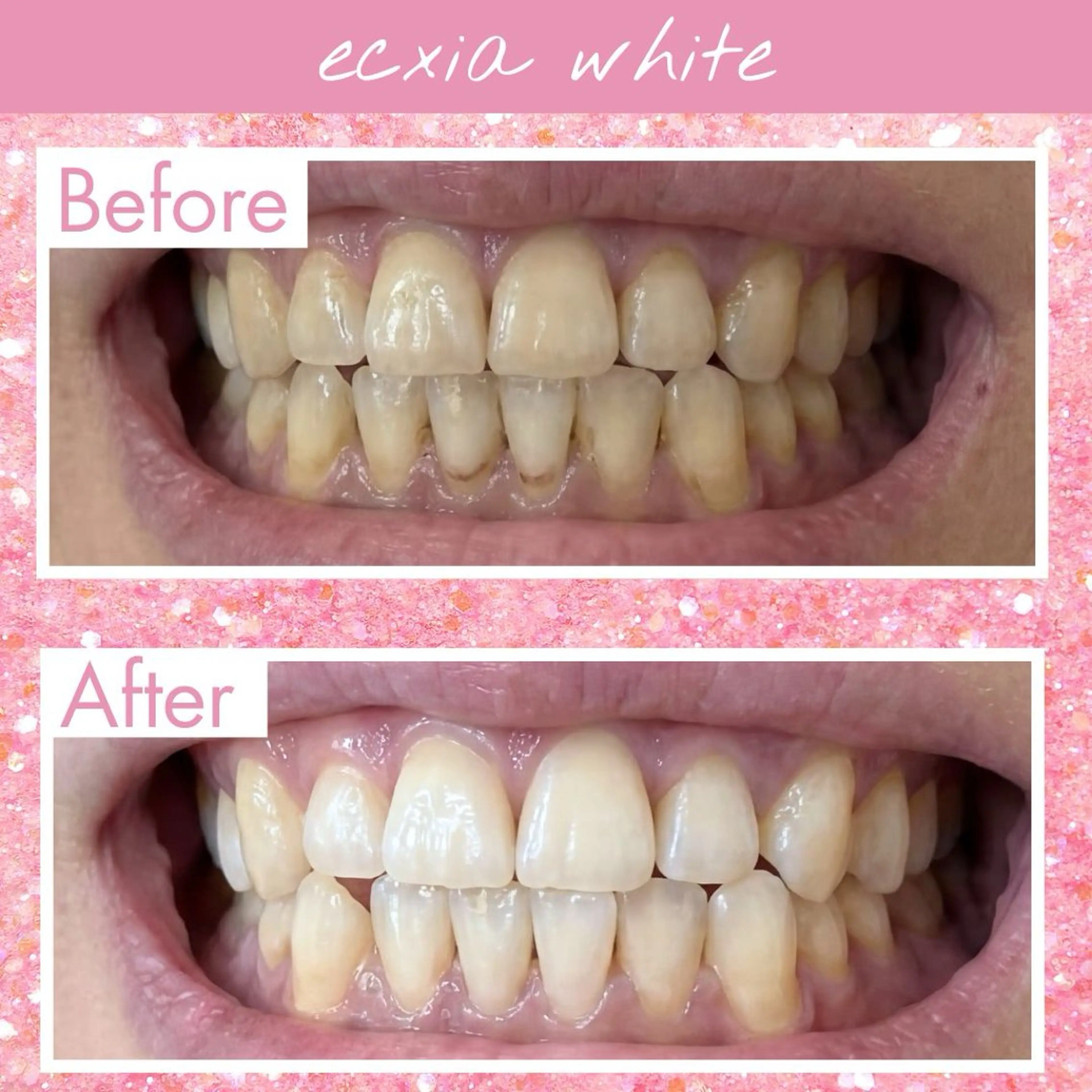 セルフホワイトニング エクシア伊勢店のその他イメージ