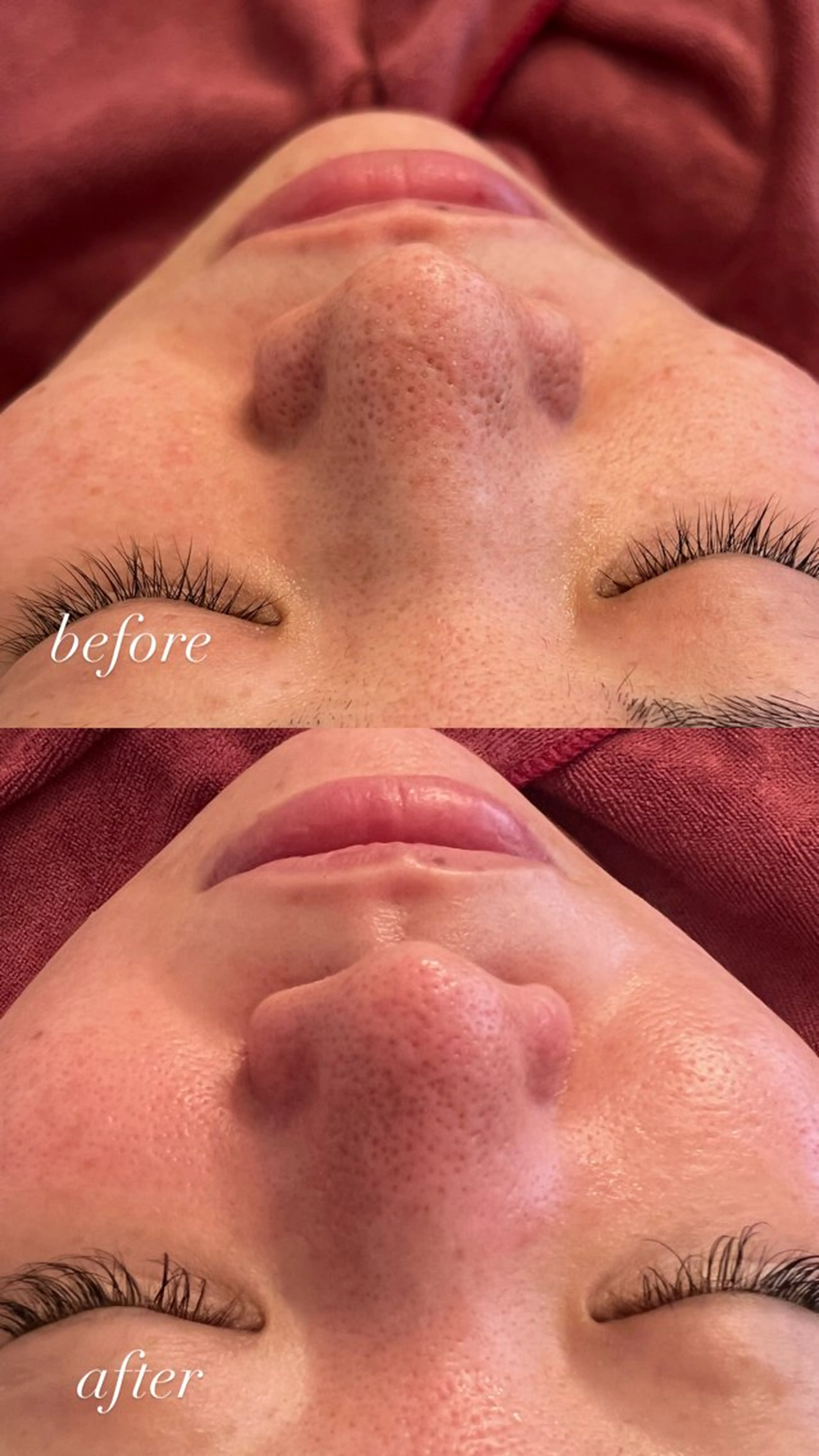 肌管理サロン neoriiのその他イメージ