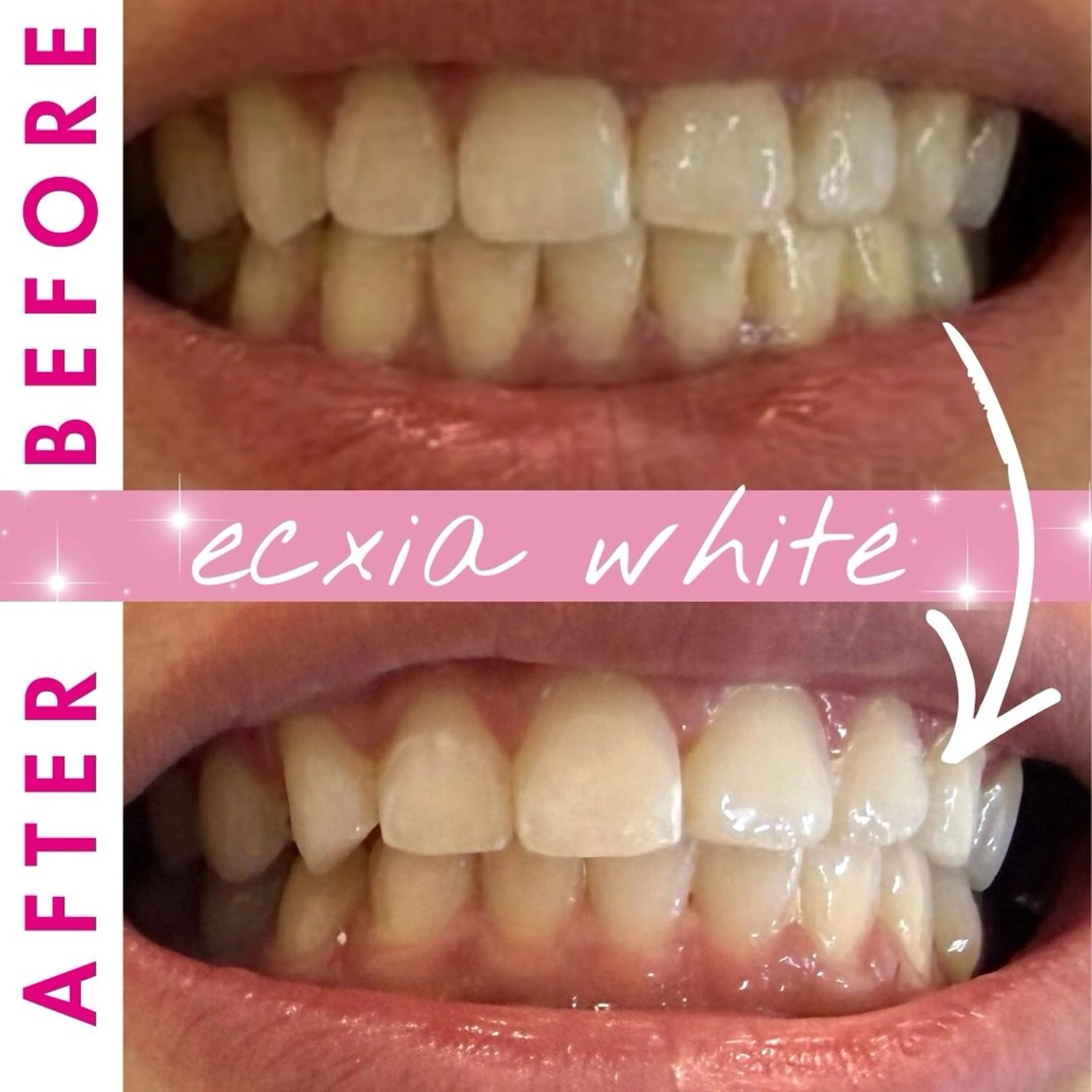 セルフホワイトニング エクシア宮崎花ヶ島店のその他イメージ