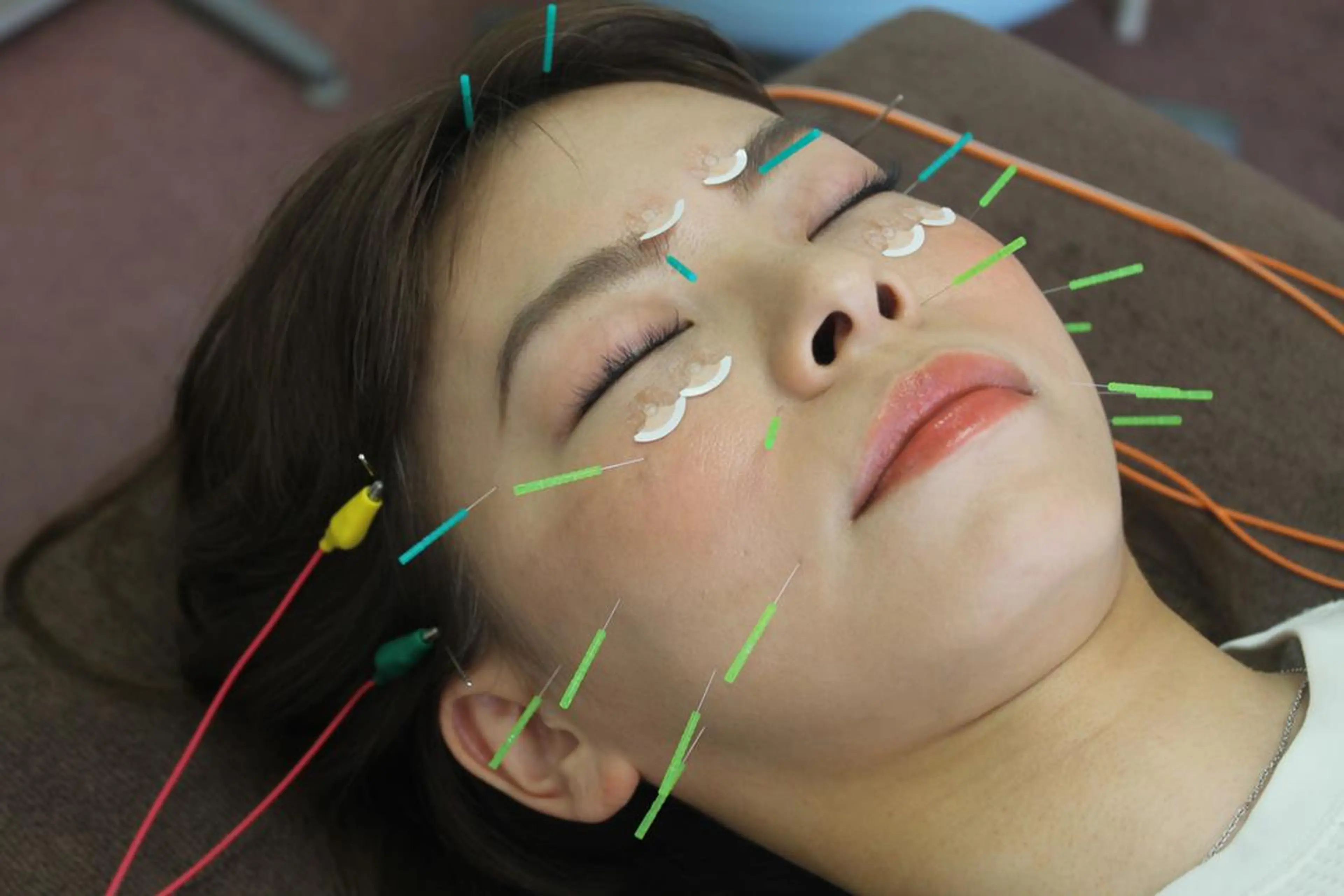 エステ 同心整骨院 美容鍼・整体・小顔のエステ・リラクイメージ