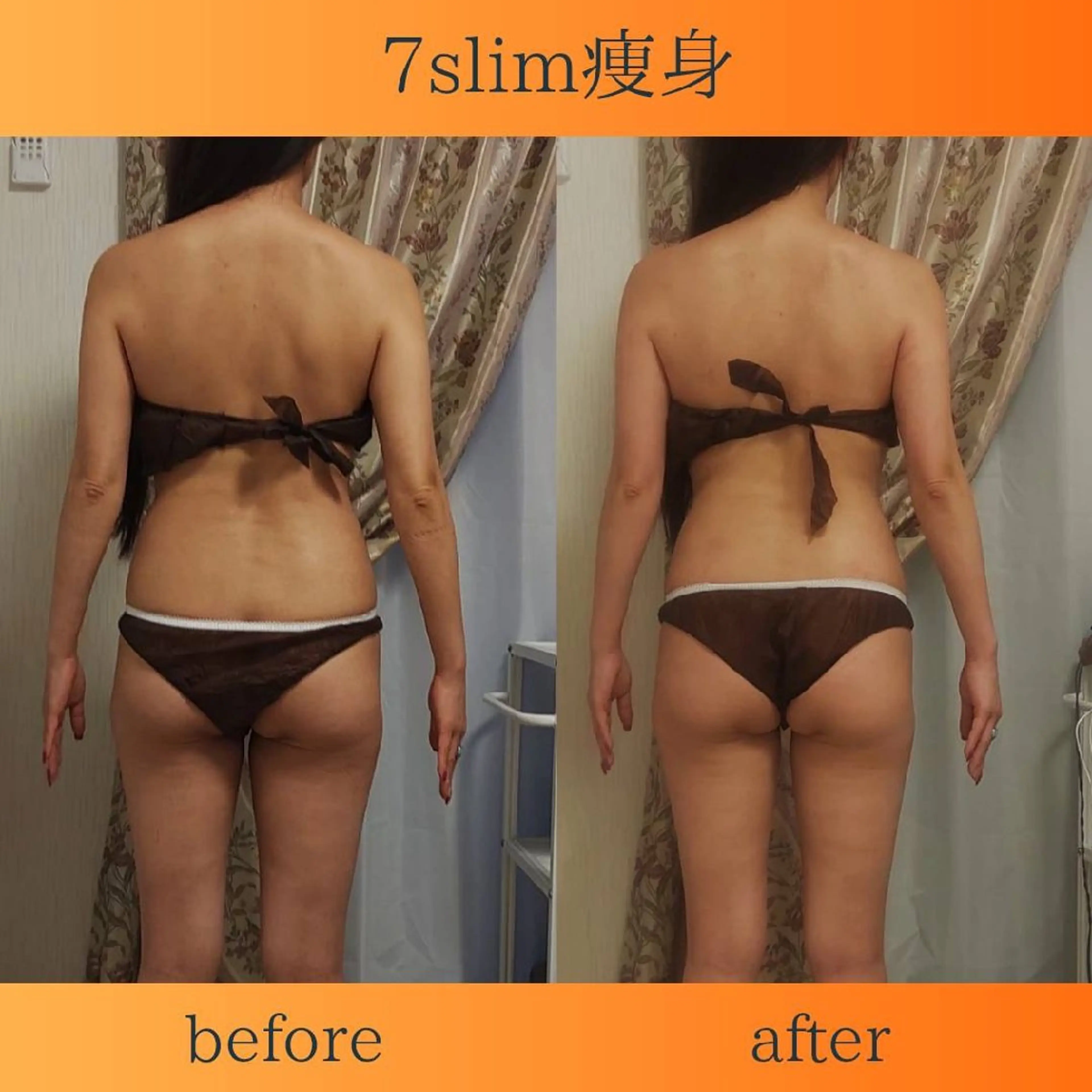 痩身小顔専門 アマテ ビューティー.Nのエステ・リラクイメージ