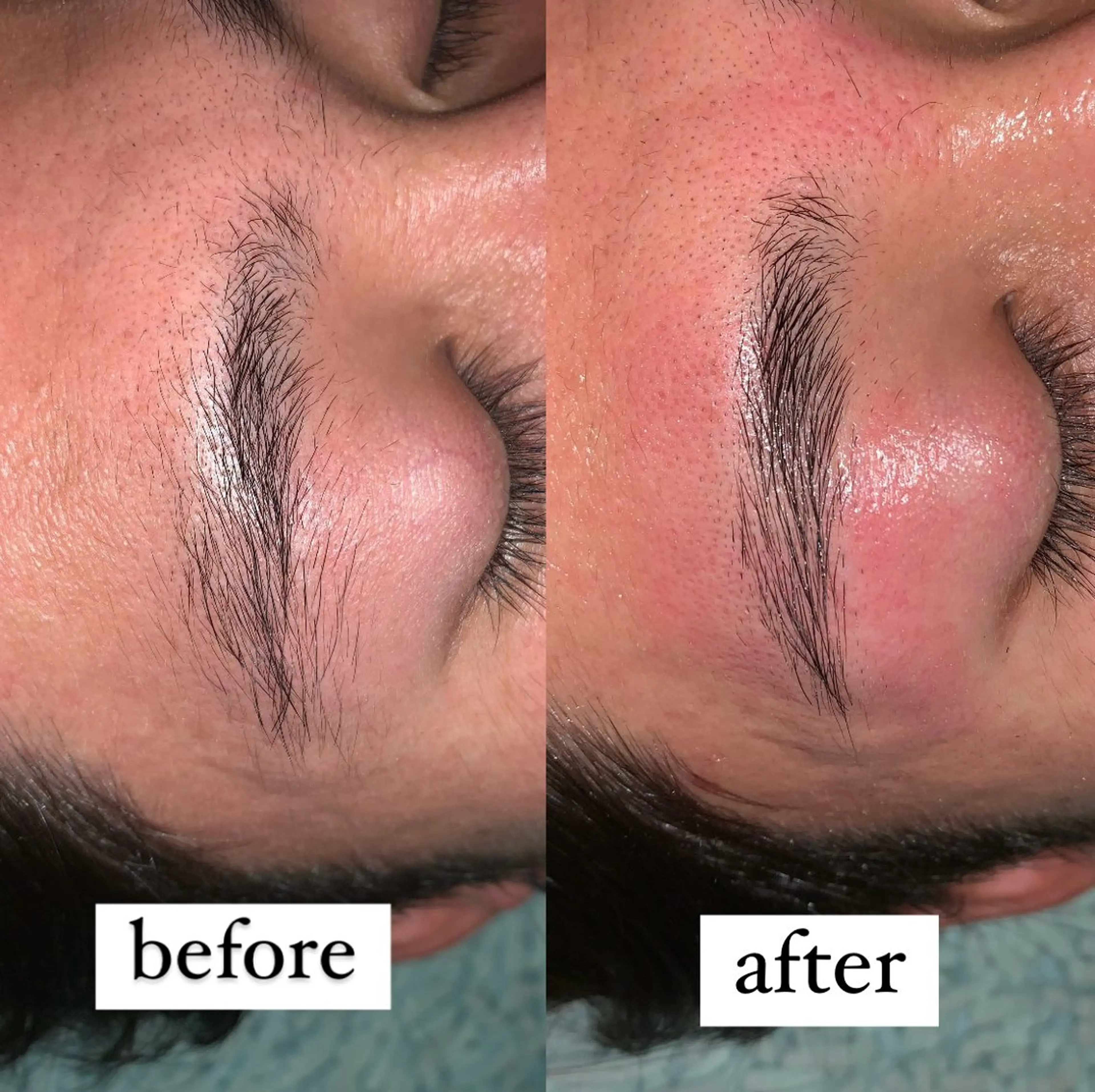 アイブロウ 眉毛ワックス脱毛 LUCEVIA ルセヴィアのその他イメージ