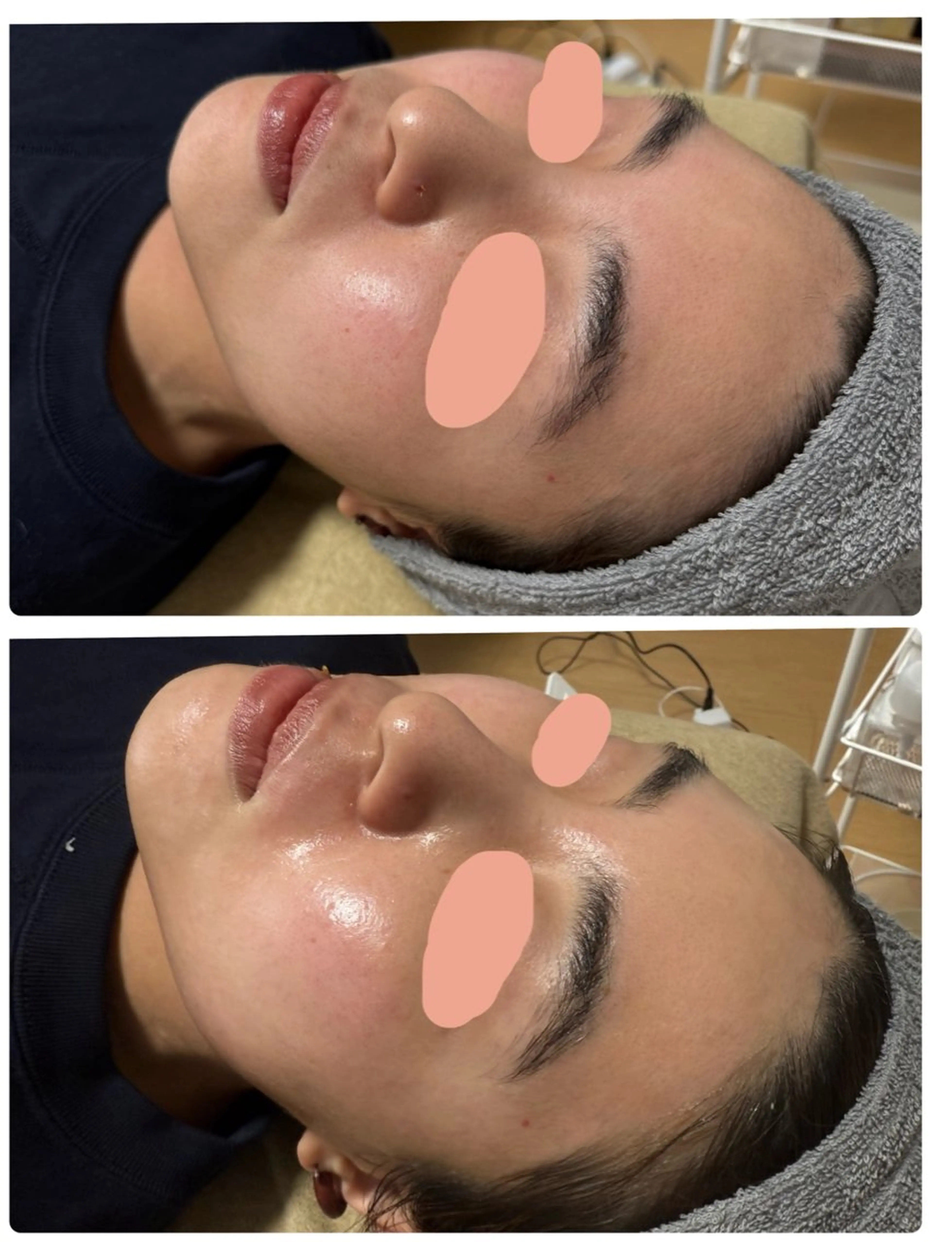 脱毛 enine フェイスWAXのエステ・リラクイメージ