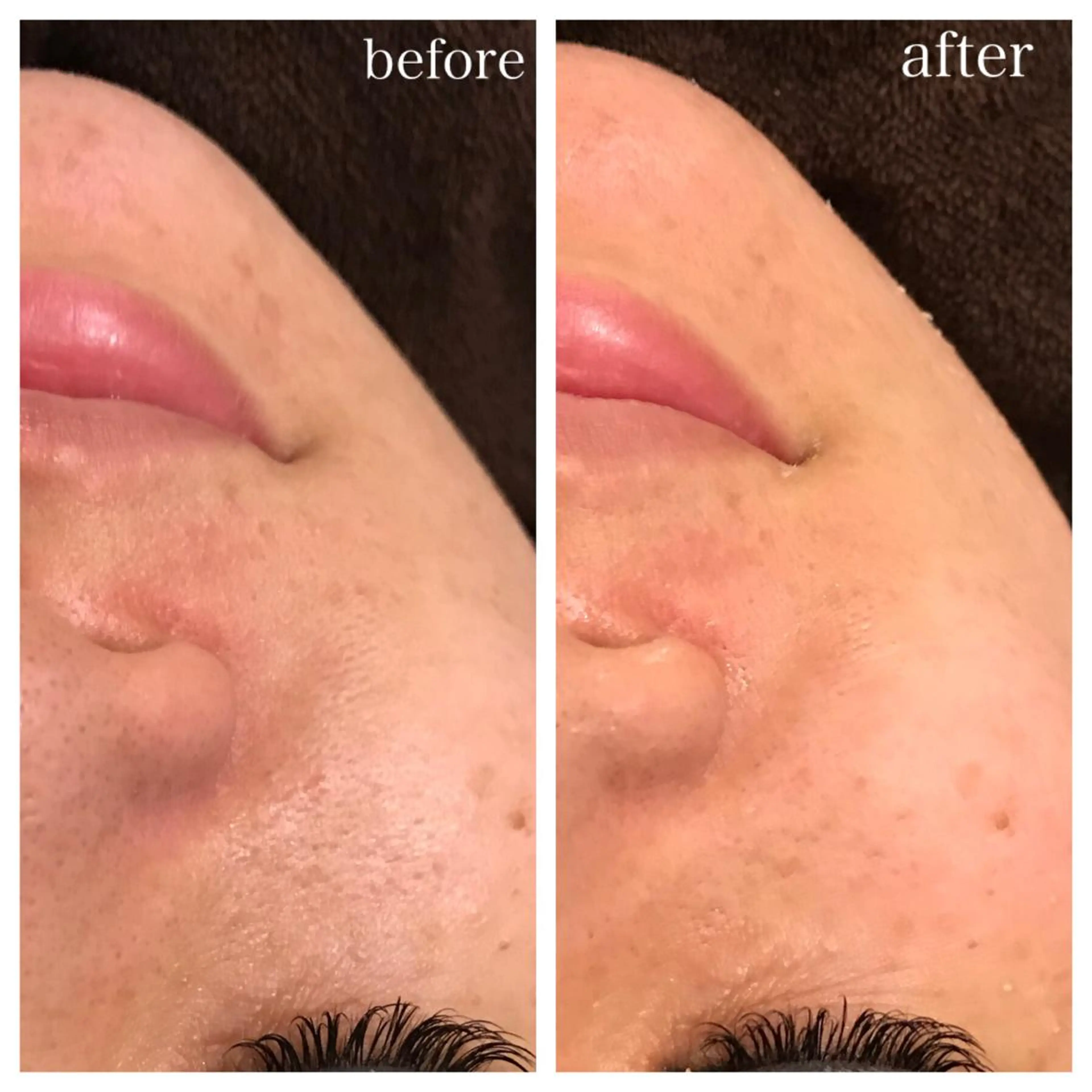 セミロング ネイル マツエク・マツパ ニキビ跡専門サロン Ａｉｎａのエステ・リラクイメージ