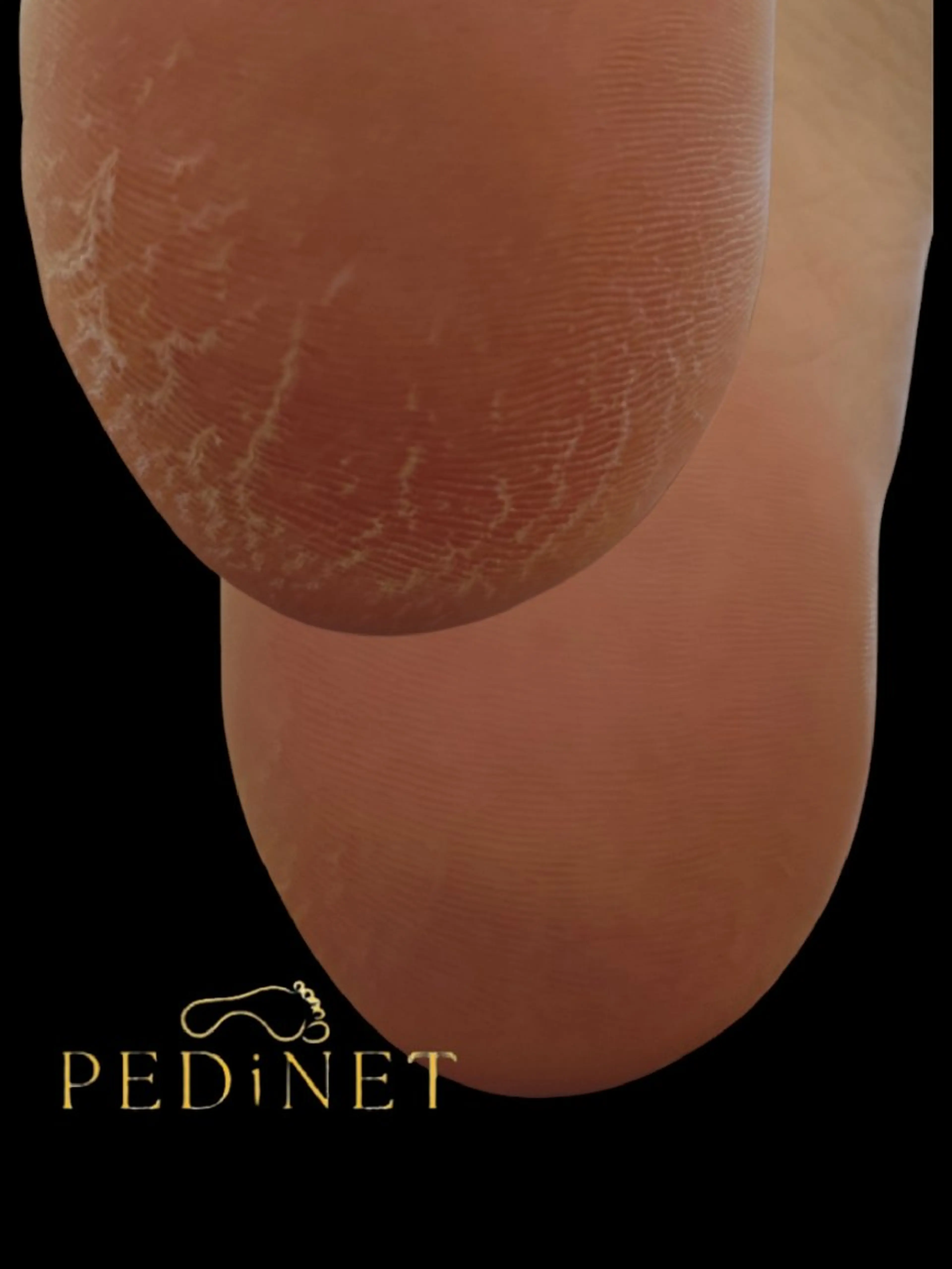 ガサガサかかとがツルツルに！韓国式🇰🇷足裏角質ケアの写真