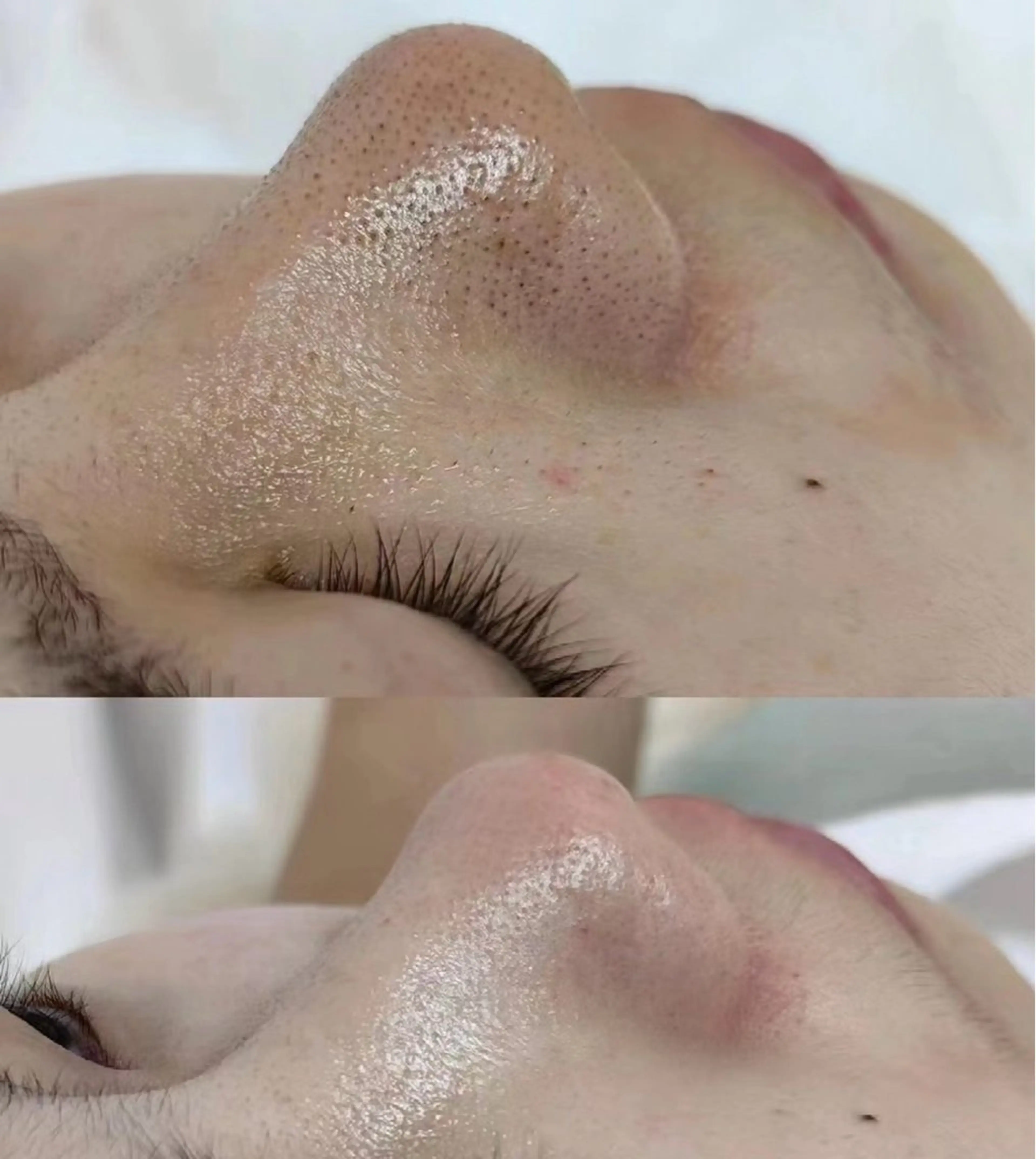 エステ リラク 愛維美水光美肌専門店所属・愛維美水光美肌専門店 メンズレディースokのエステ・リラクイメージ